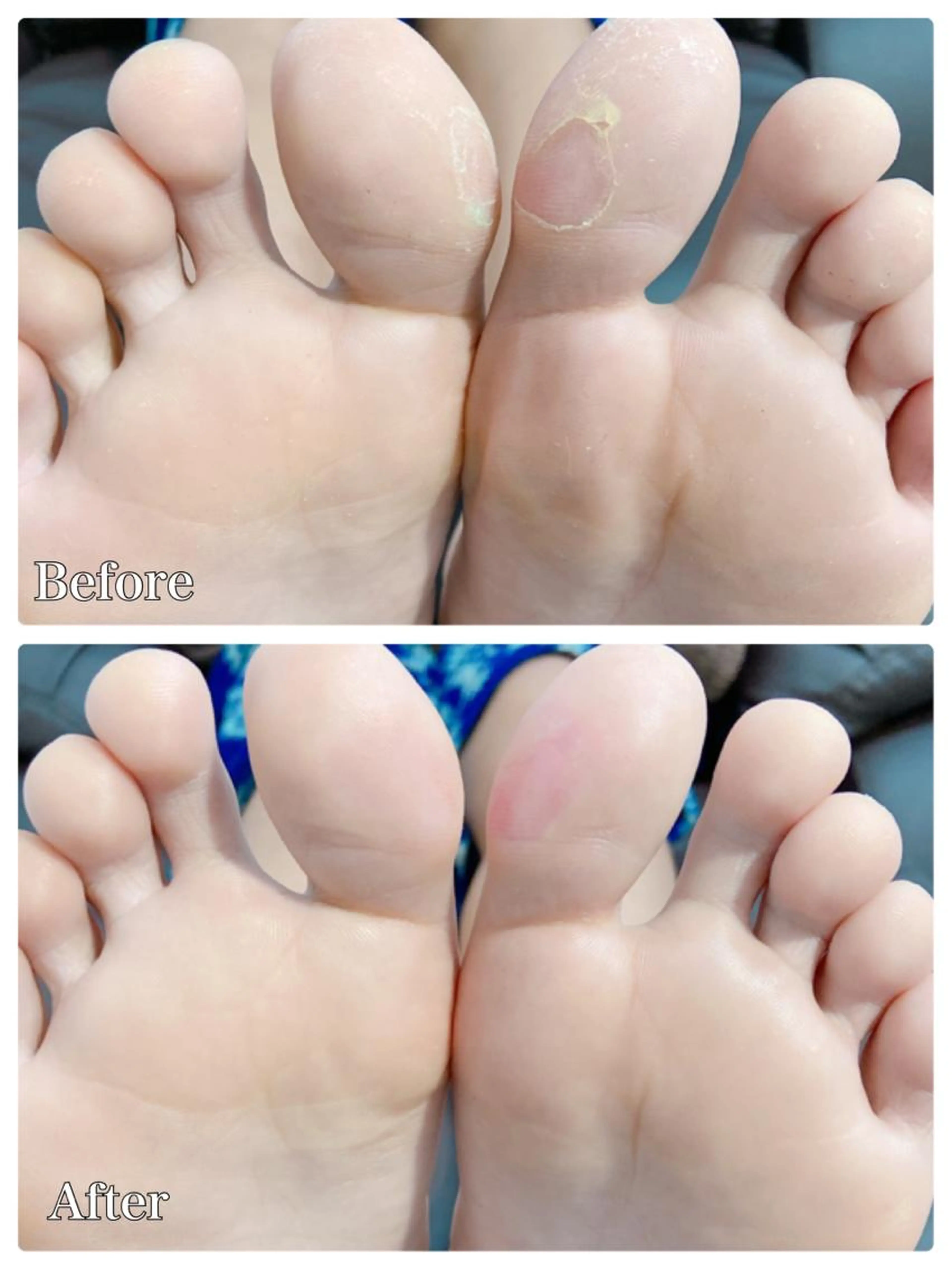 極上フットケア(オフなし)の写真