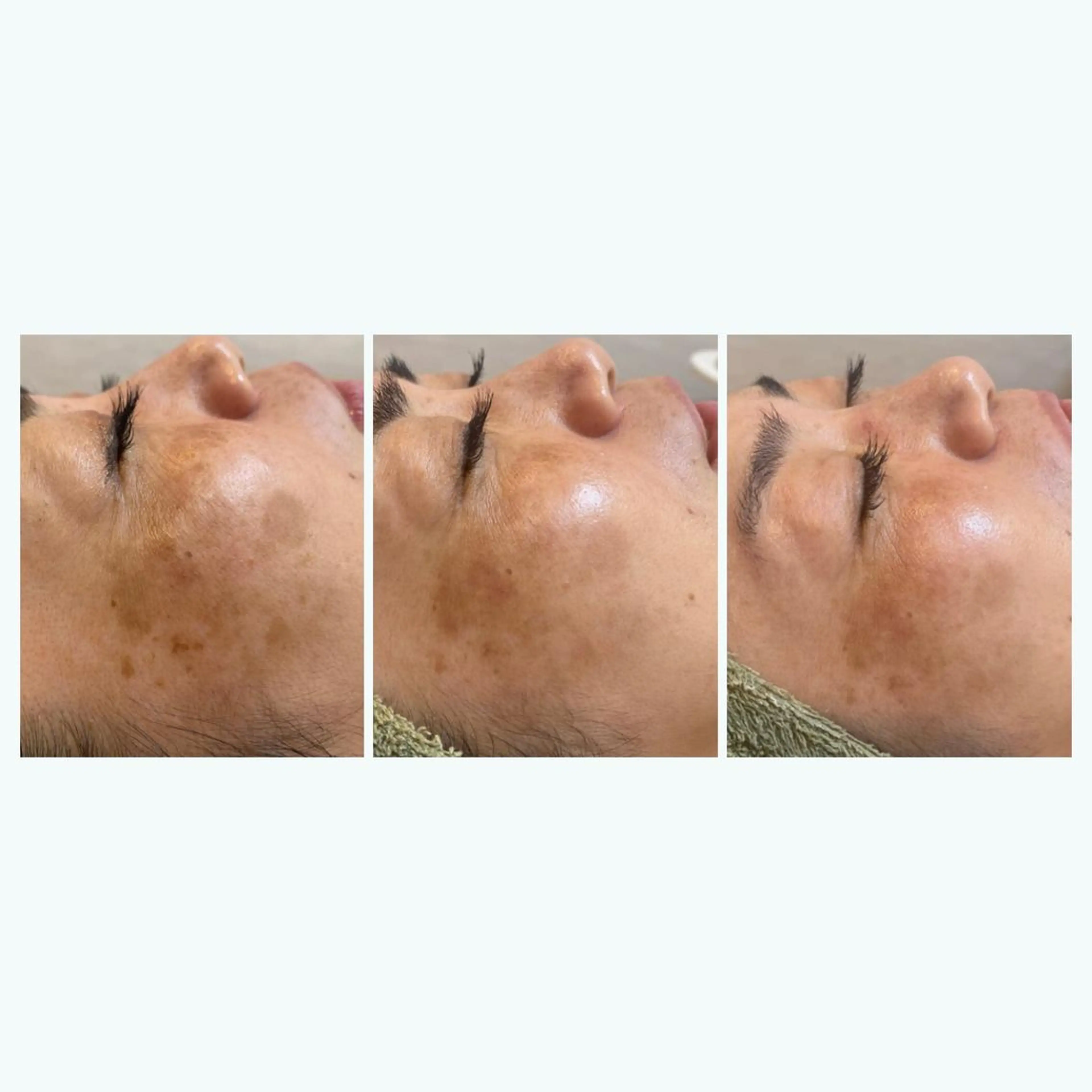 脱毛｜ピーリング ROOM.Sのエステ・リラクイメージ