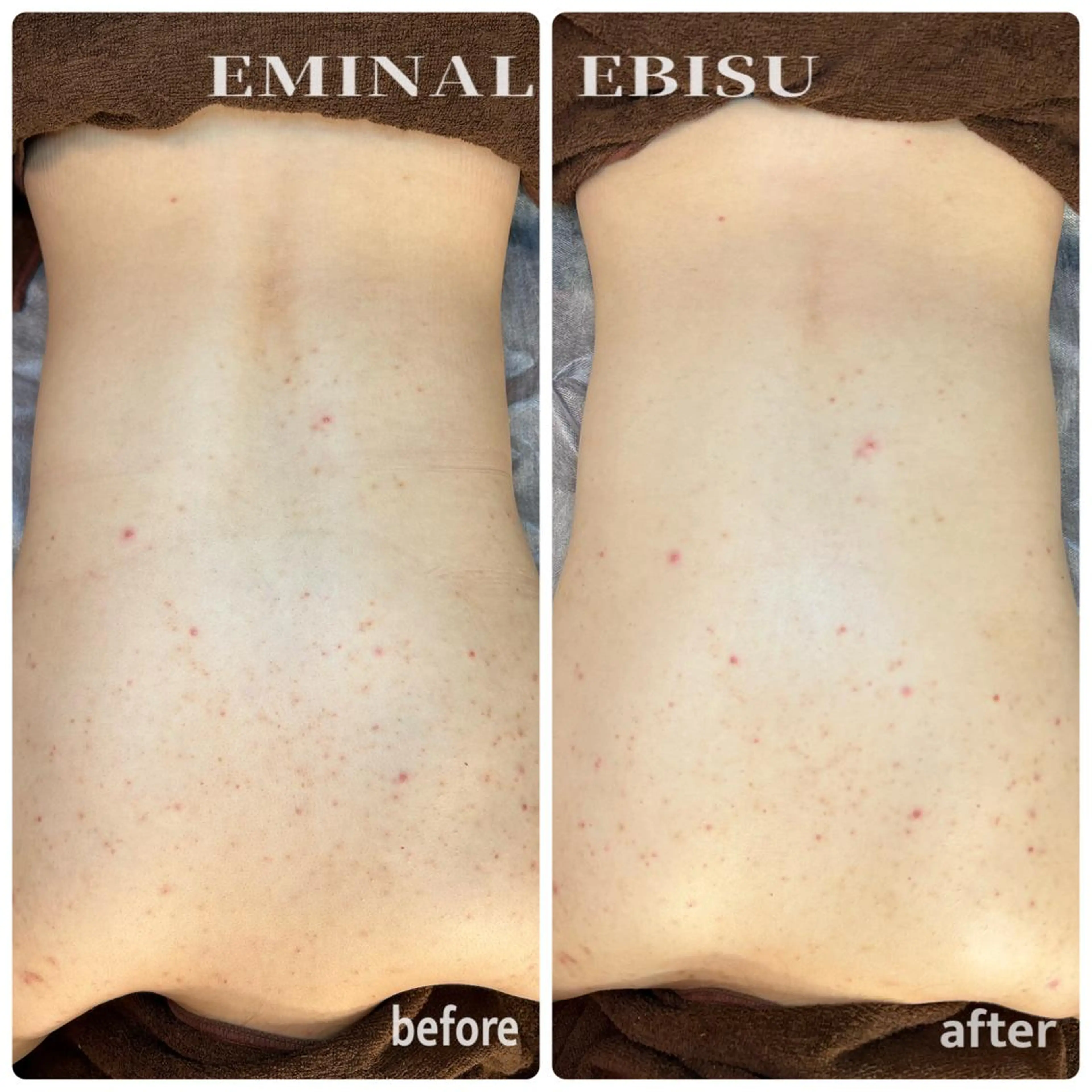 EMINAL恵比寿 HITOMIのエステ・リラクイメージ