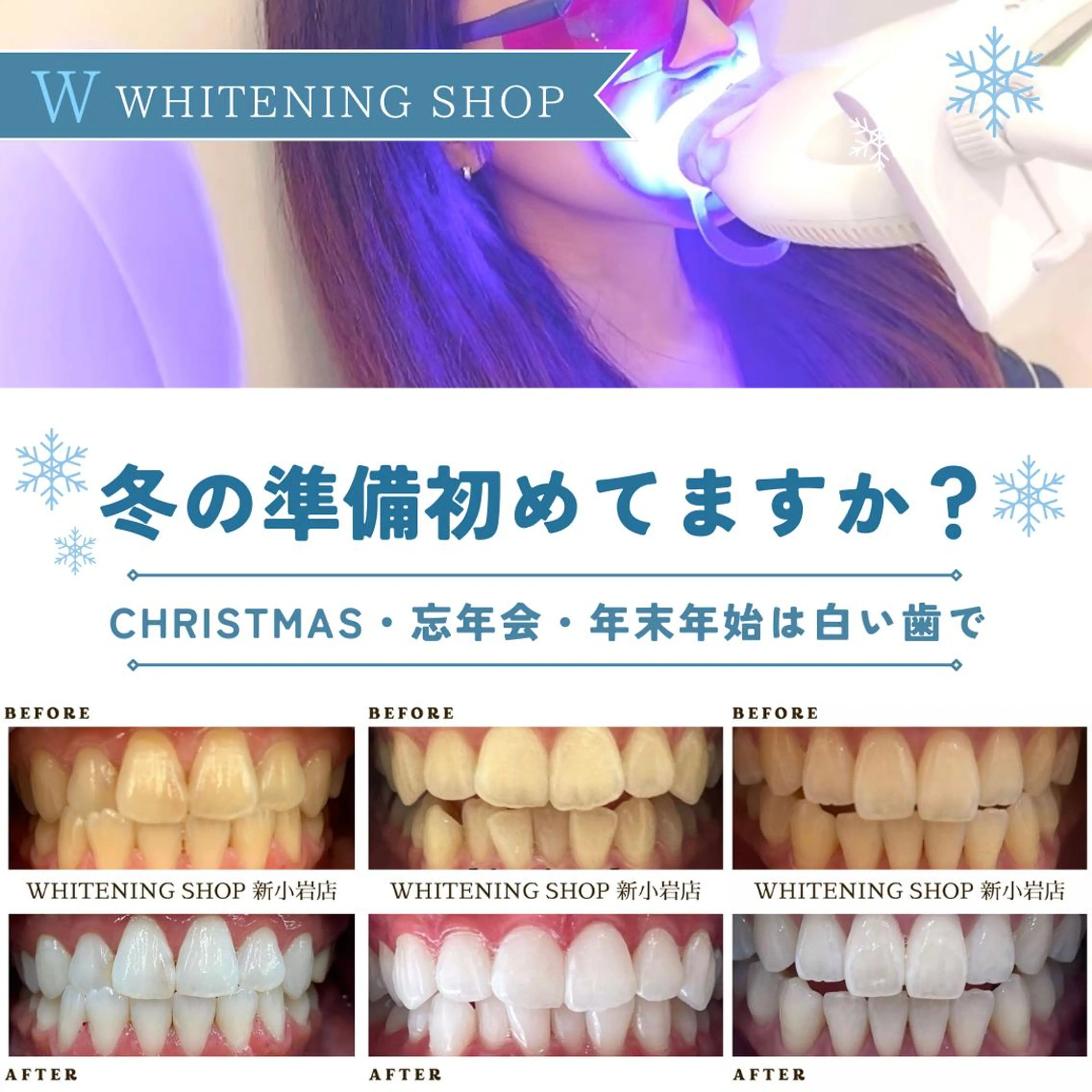 メンズ クリスマス その他 ホワイトニング ショップ新小岩店のその他イメージ