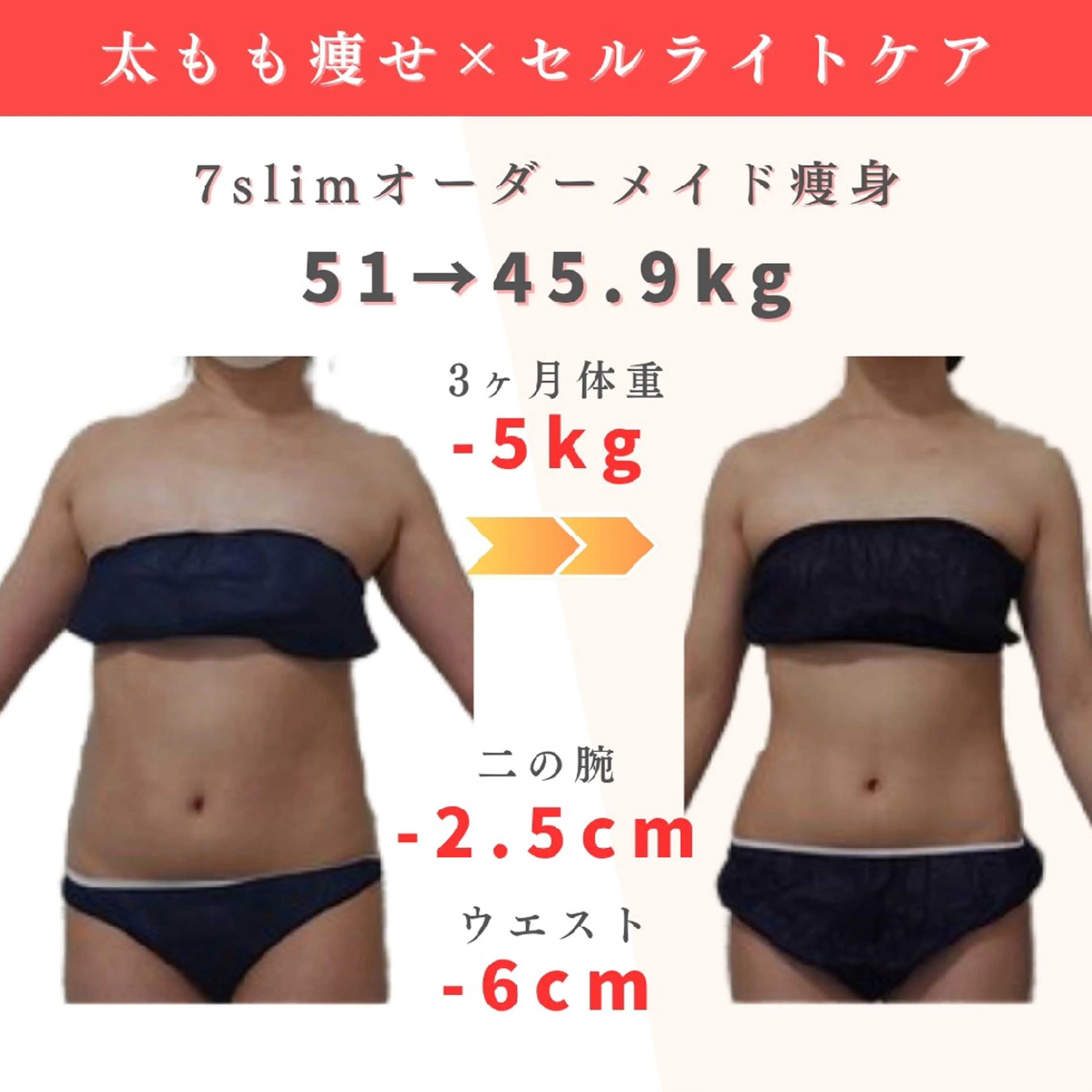 モニター特別価格◇全身オーダーメード7slim痩身90分の写真