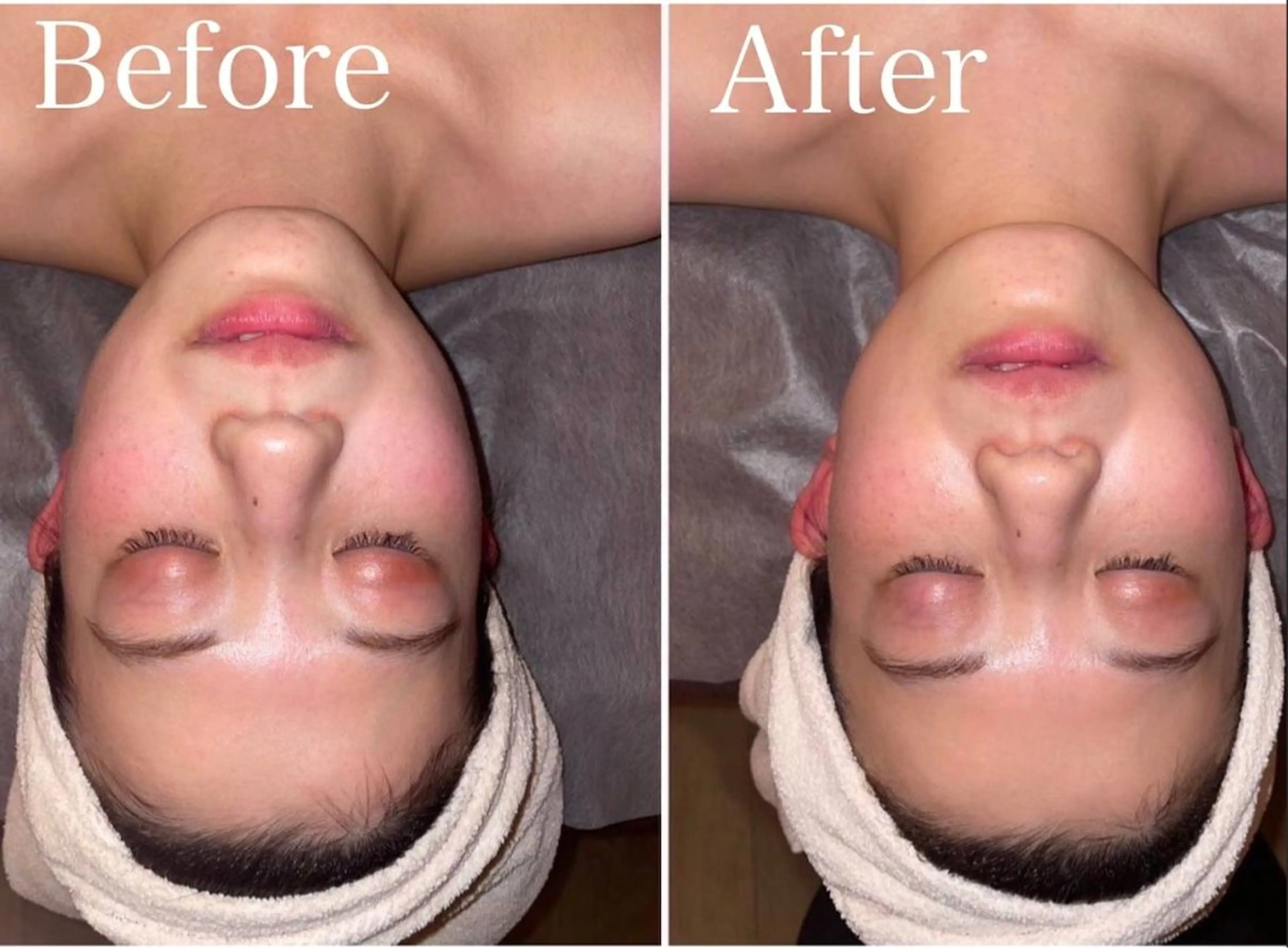 脱毛サロン ナチュリス所属・玉井 美子のエステ・リラクイメージ