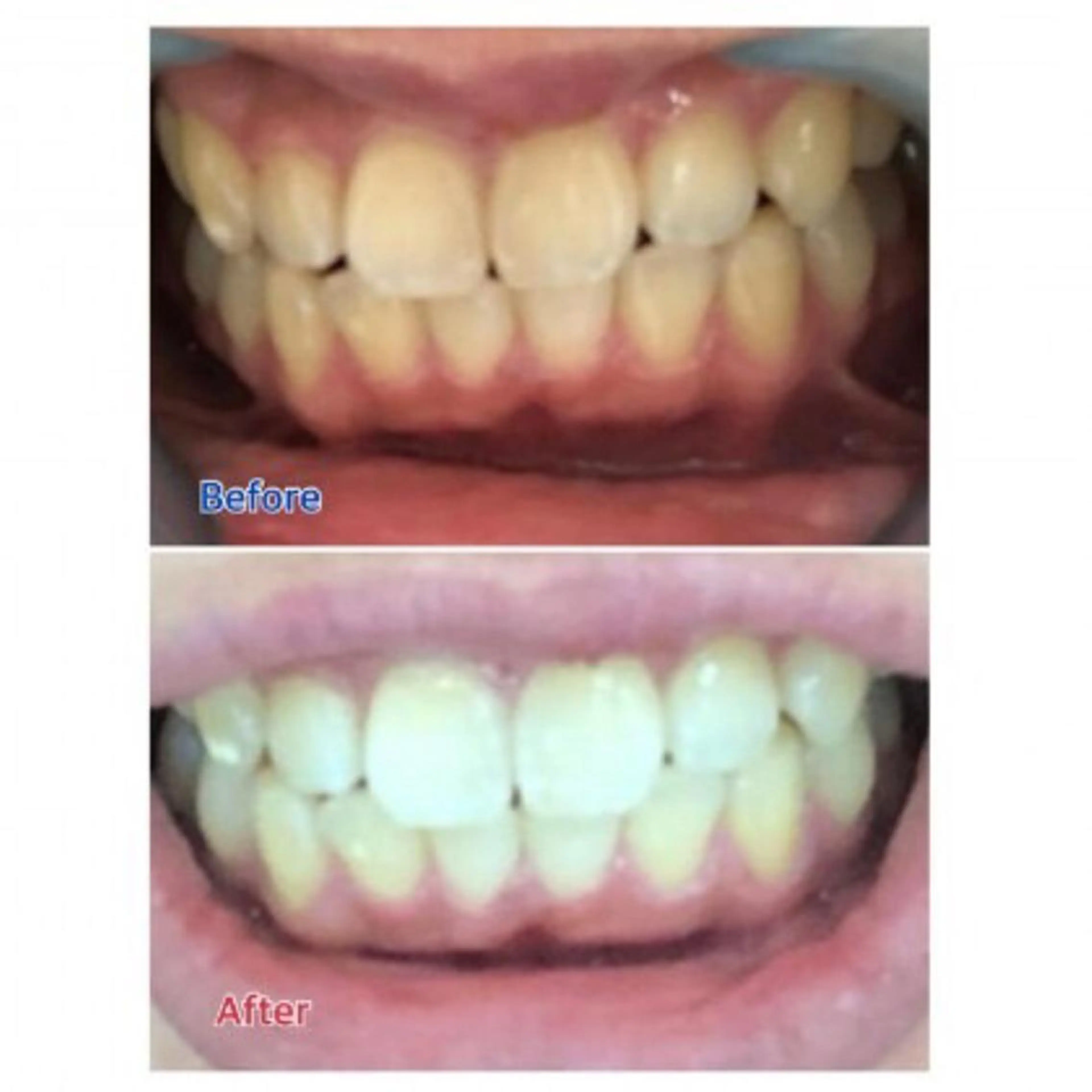 M渋谷店所属・Ｍ渋谷 ホワイトニングのエステ・リラクイメージ