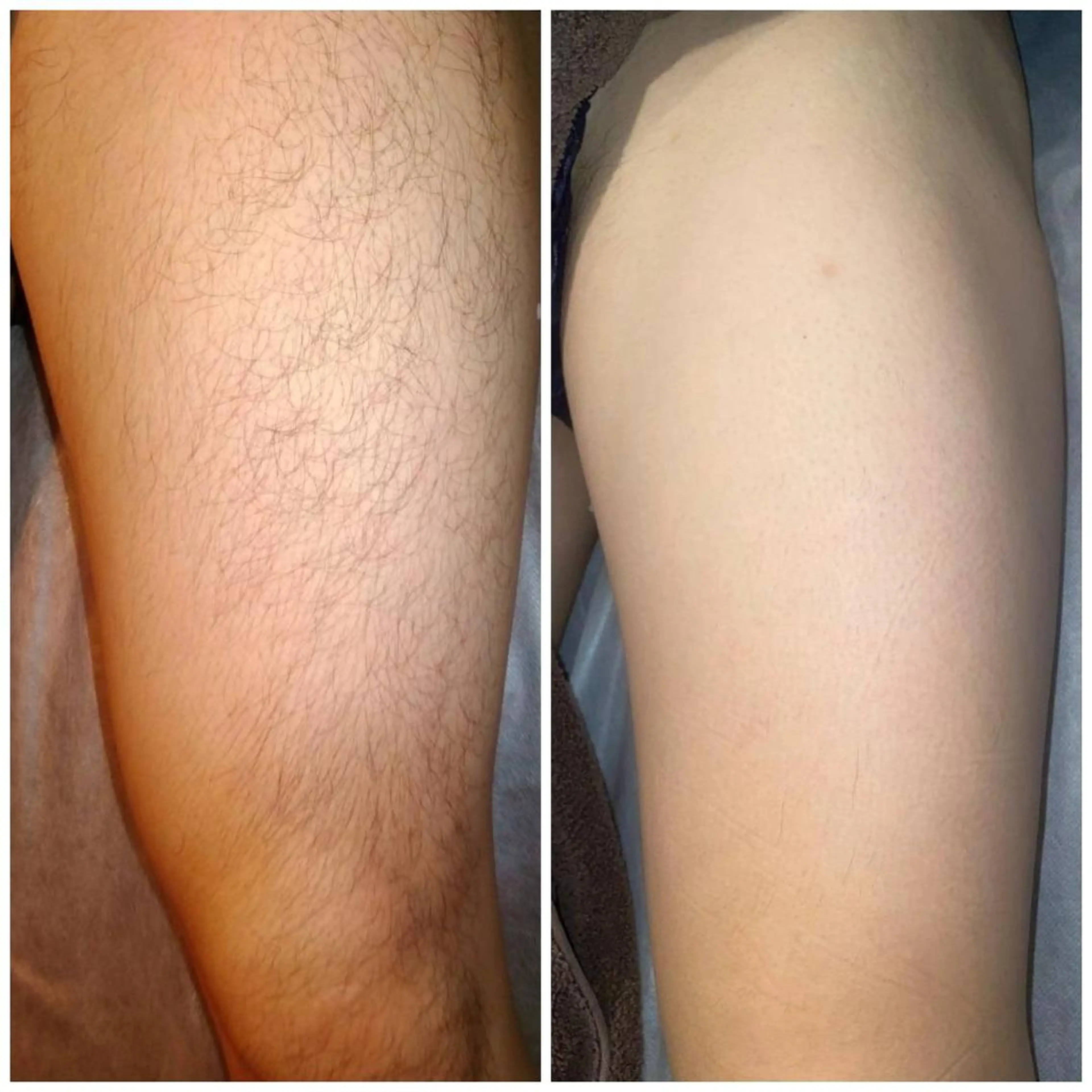 脱毛・眉毛・フェイス サロンN久留米店の眉毛・アイブロウイメージ