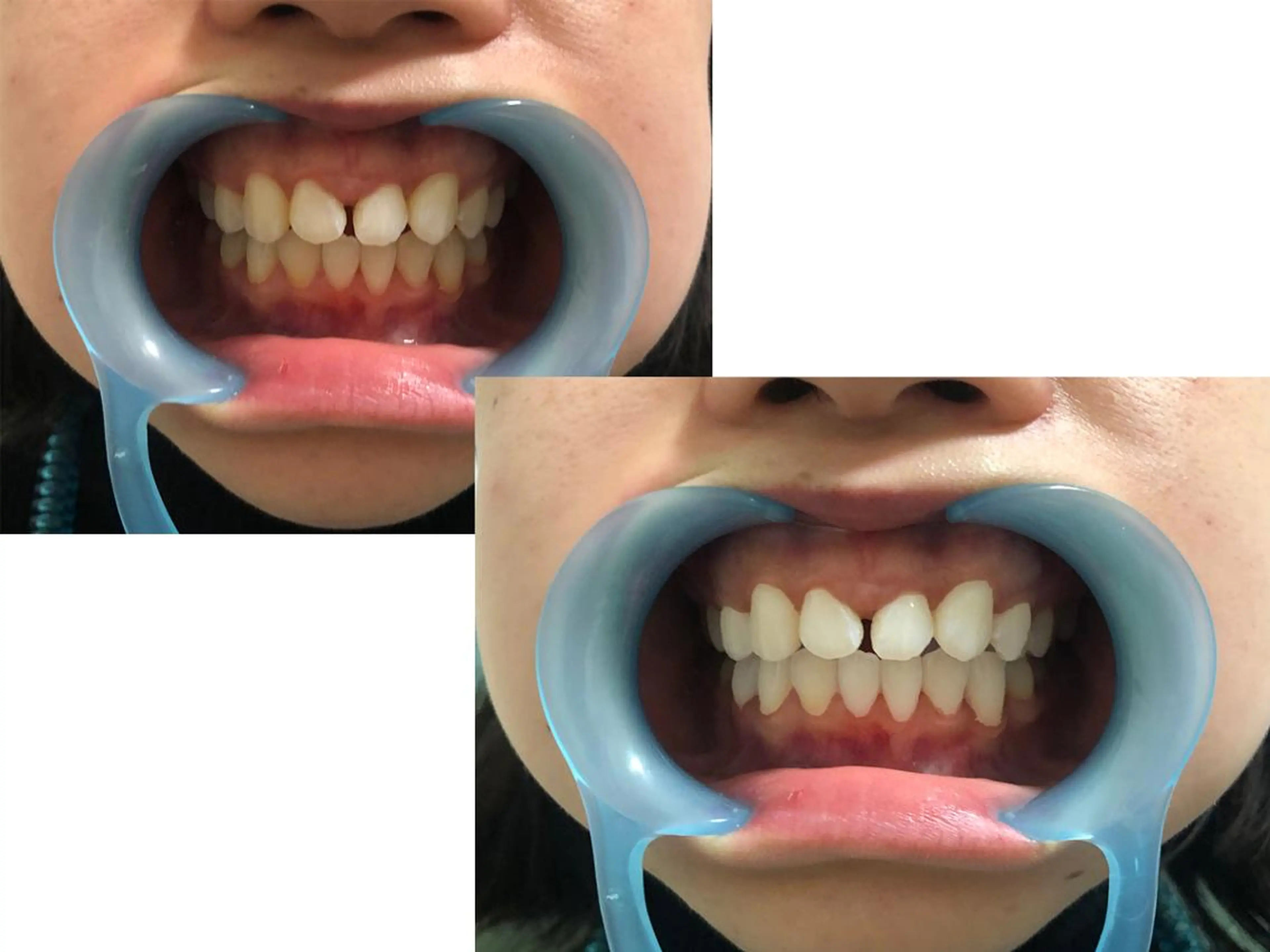 ミディアム カラー キッズ パーマ ネイル ヘアアレンジ マツエク・マツパ メンズ アイブロウ 結婚式・ブライダル 結婚式・ブライダル ブライダルネイル ホワイト 中目黒 ホワイトニングサロンのその他イメージ