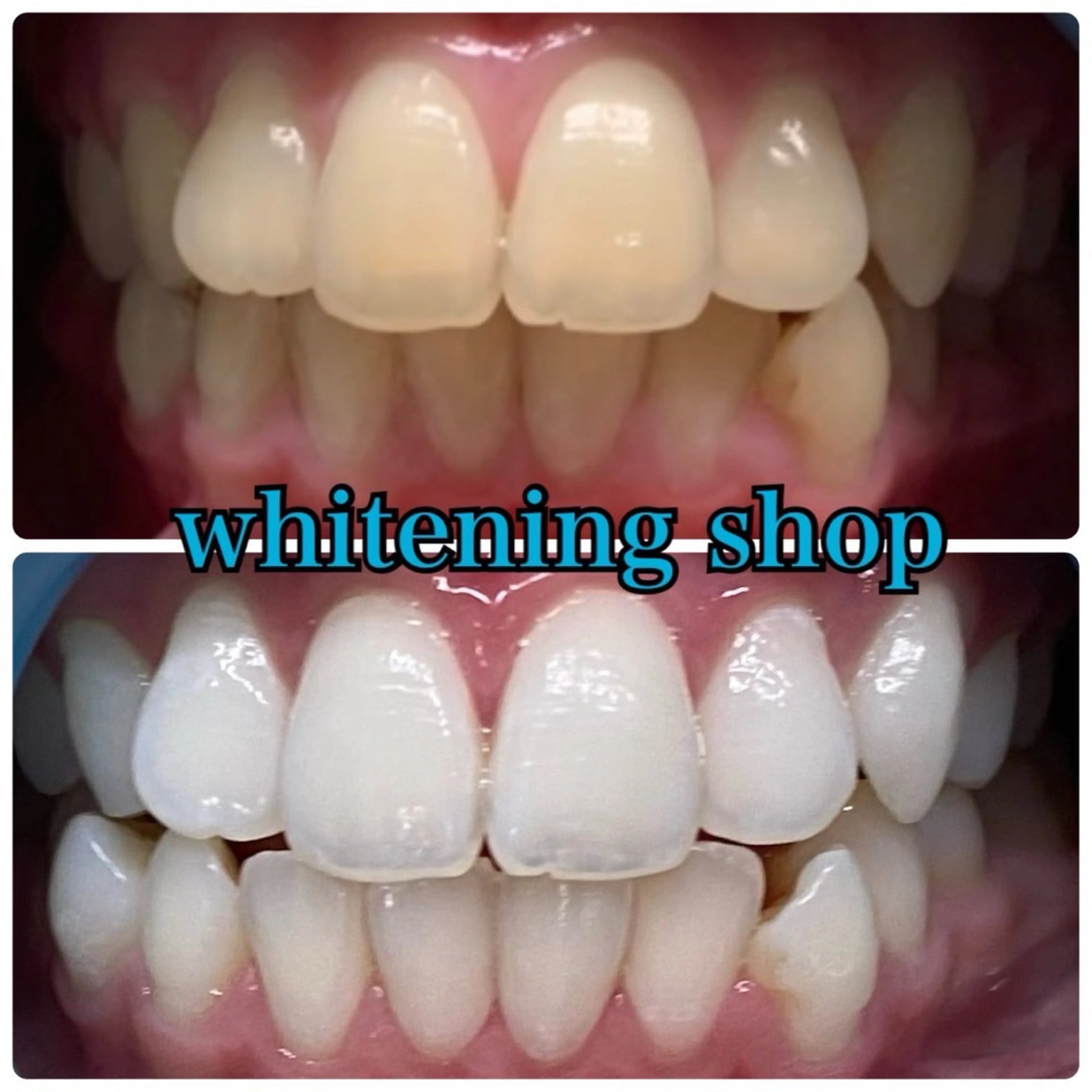 メンズ エステ リラク ホワイトニング ショップ川越店のエステ・リラクイメージ