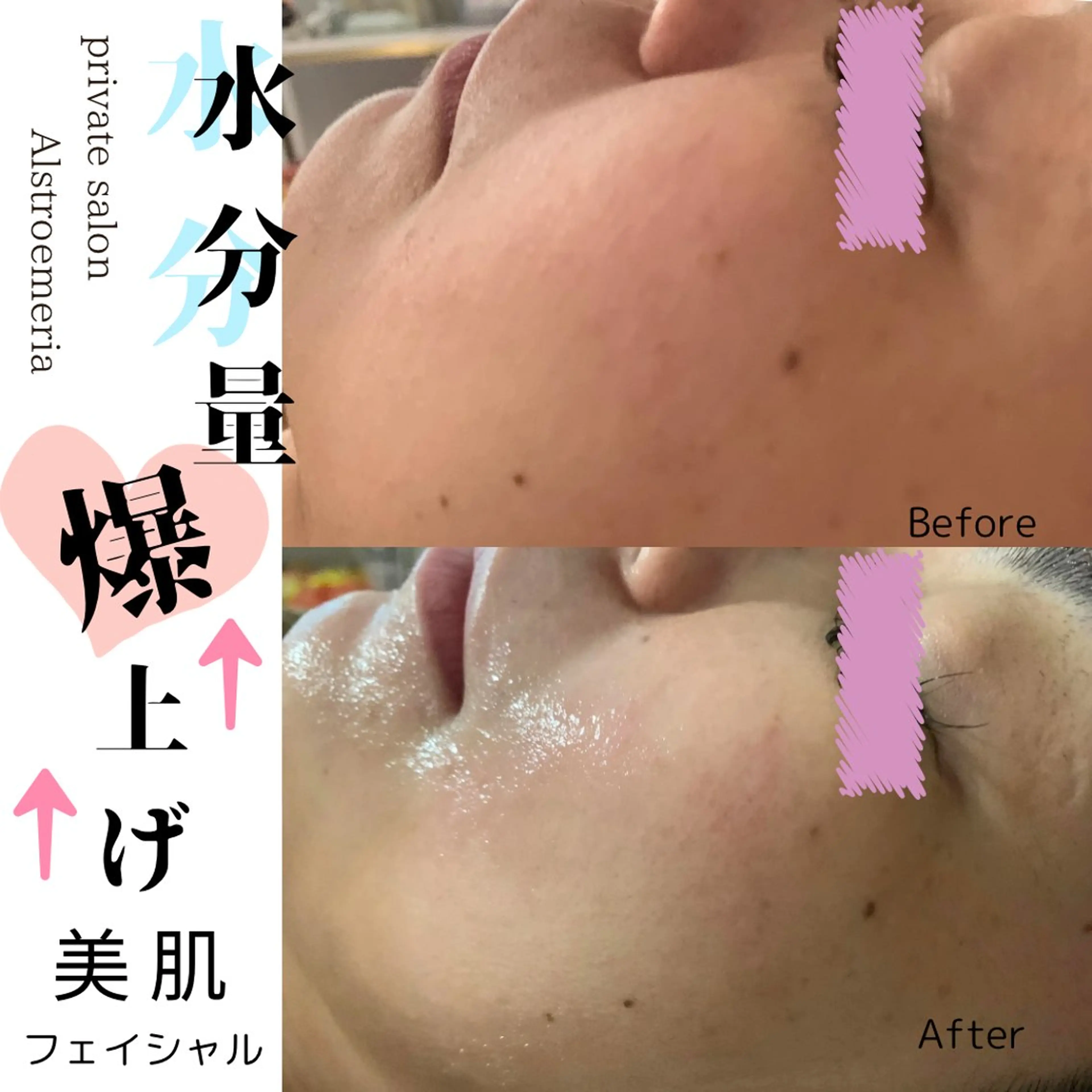 モニターご協力の方✨限定♡オールハンド美肌フェイシャル💆‍♀️の写真