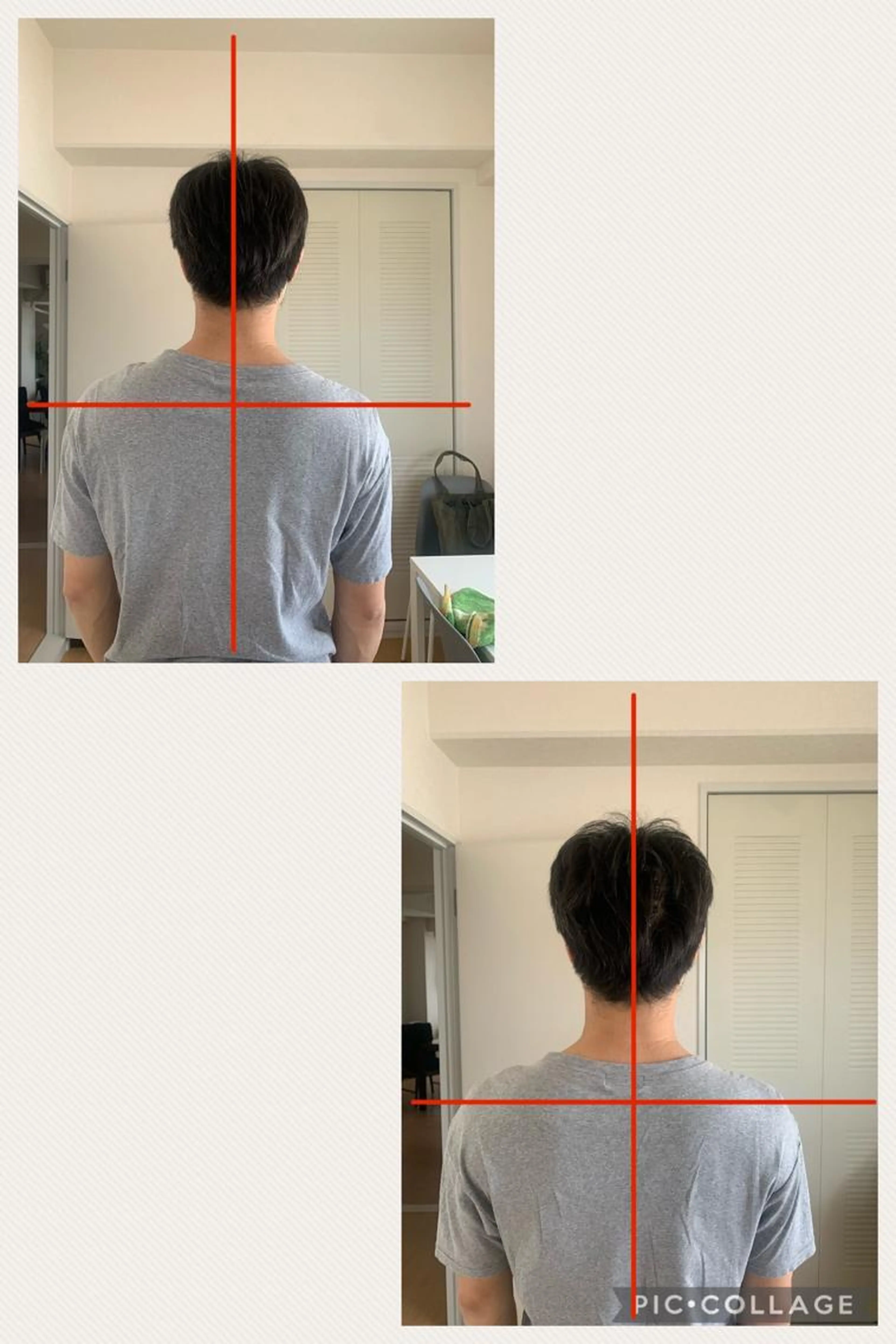 首がしんどい、つらい！お試しキャンペーン(2回で1,980円)の写真