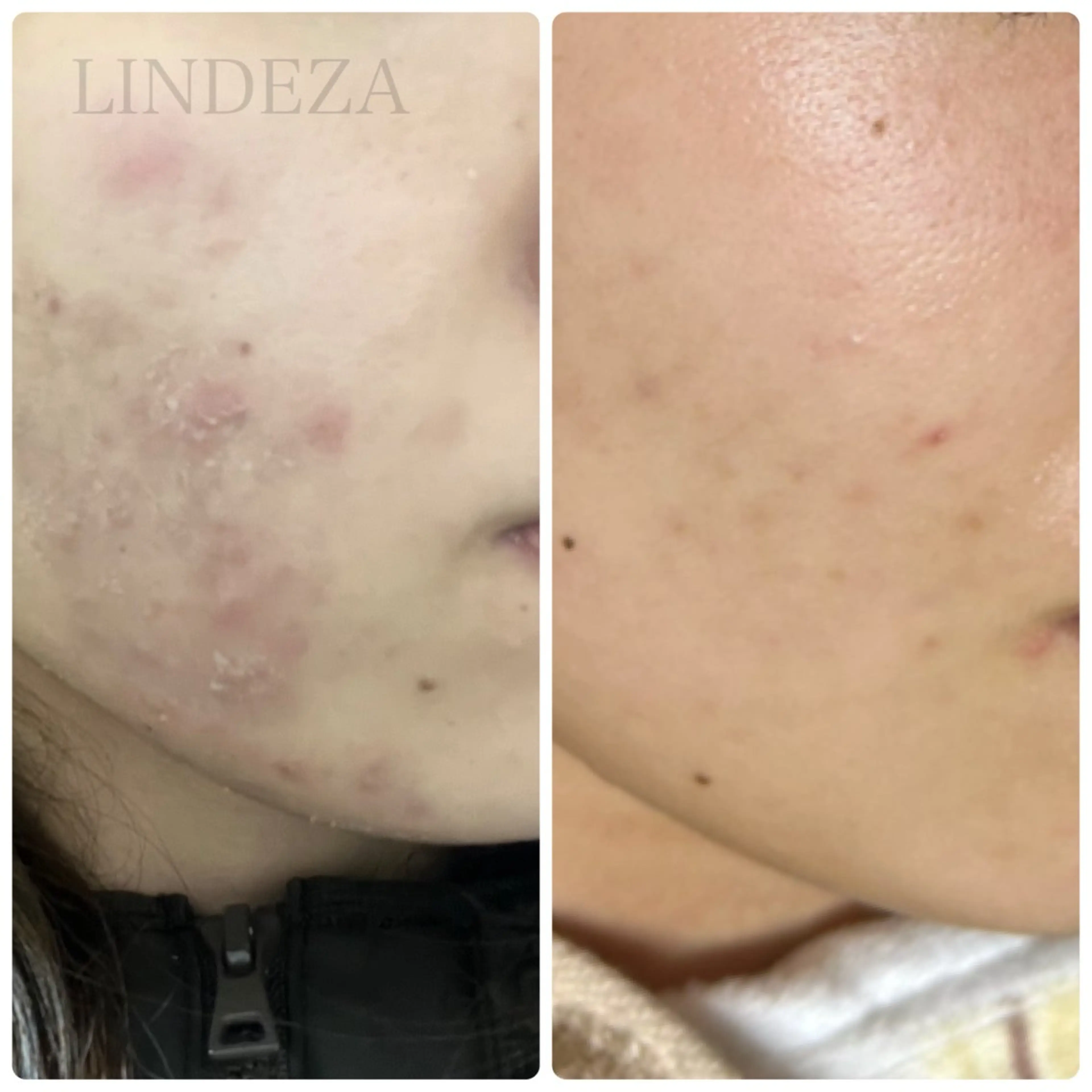 private salon 𝐋𝐈𝐍𝐃𝐄𝐙𝐀所属・LINDEZA Ayaのエステ・リラクイメージ