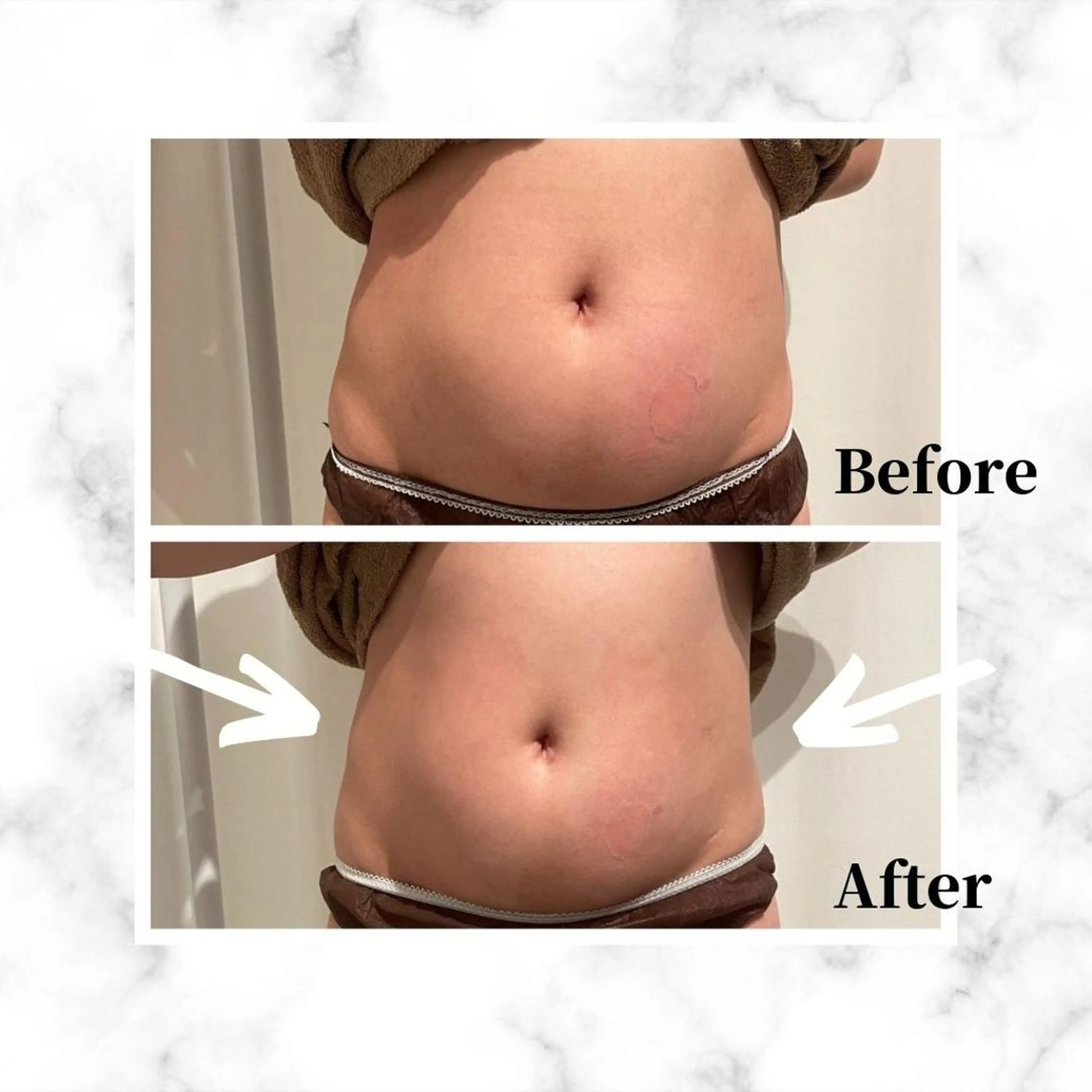 エステ リラク 12Dハイフ💗 最強小顔のエステ・リラクイメージ