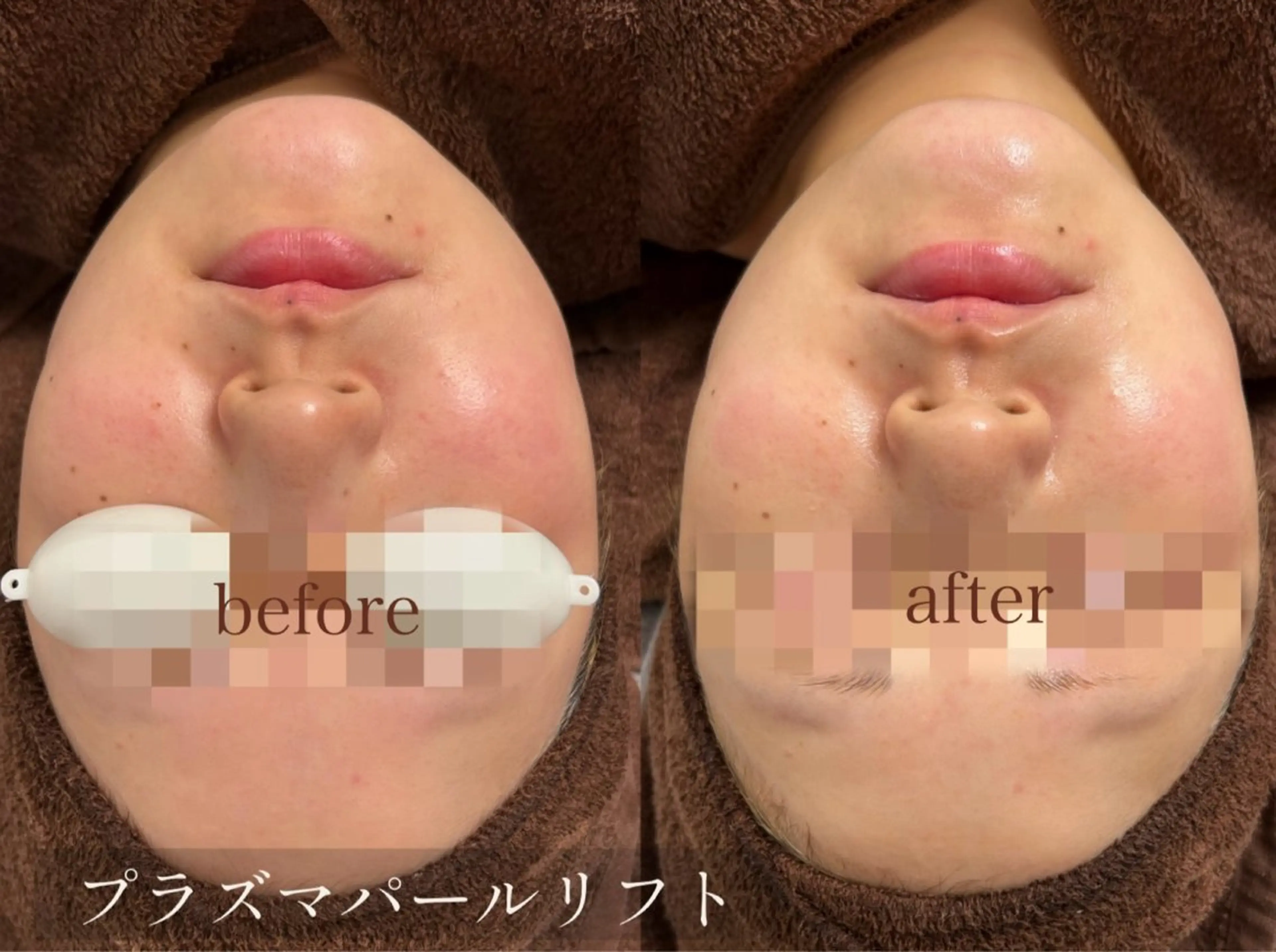 saron Mのエステ・リラクイメージ