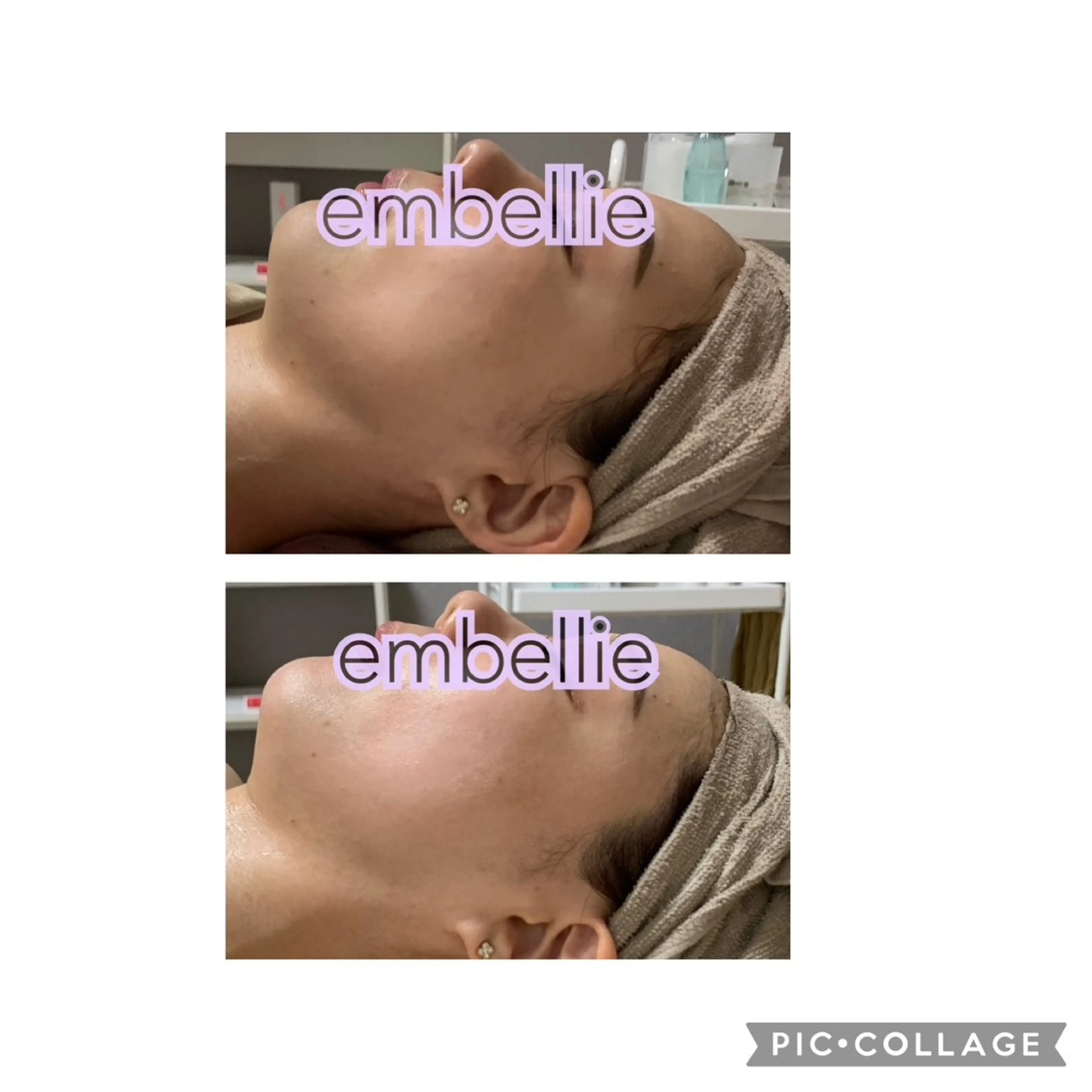 エステ miyasaka erikoのネイルデザイン