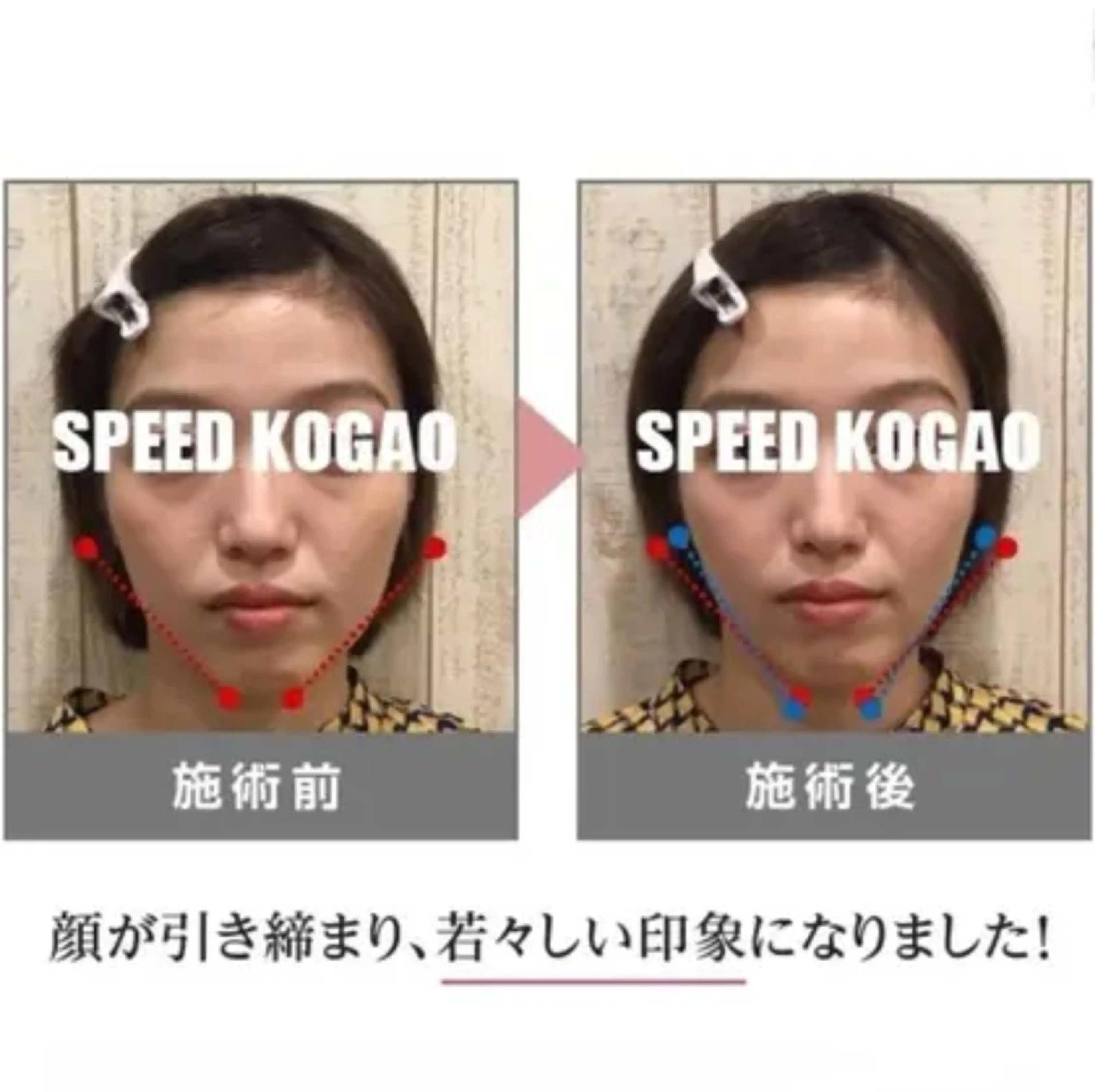 小顔矯正 natsuのエステ・リラクイメージ