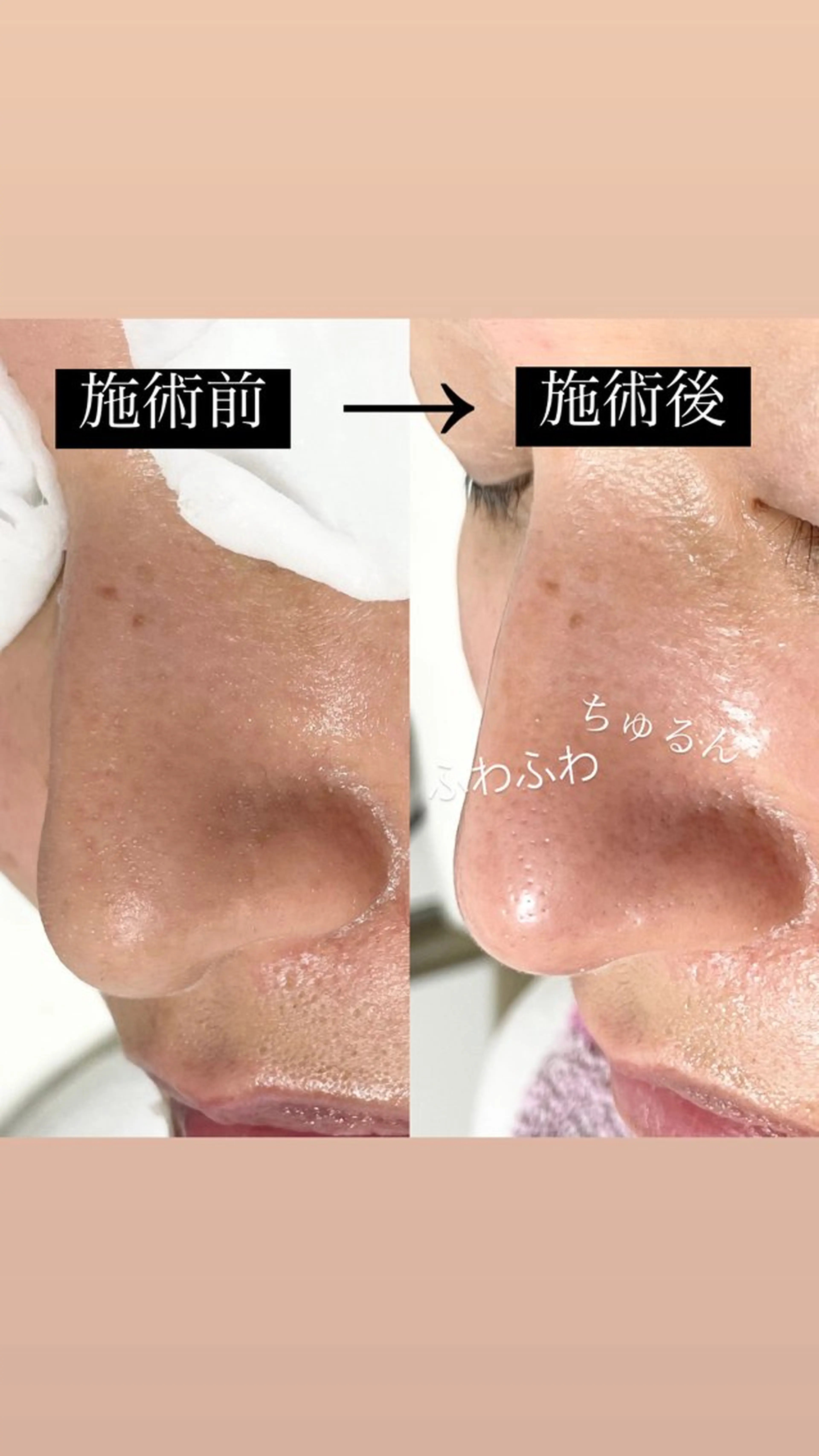 Salon Lily MARIのエステ・リラクイメージ