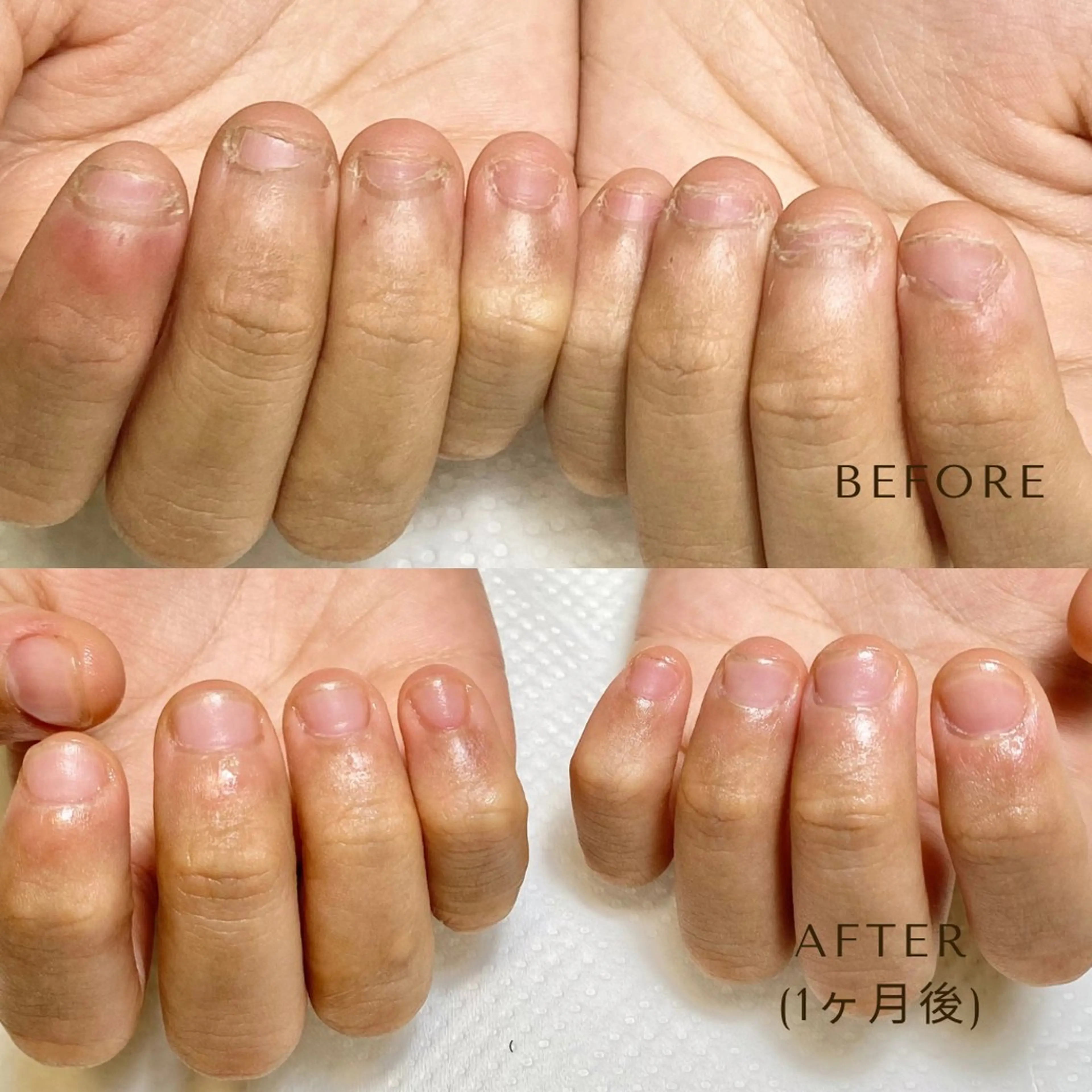 ネイル 自爪育成nail &eyelashのマツエク・マツパデザイン