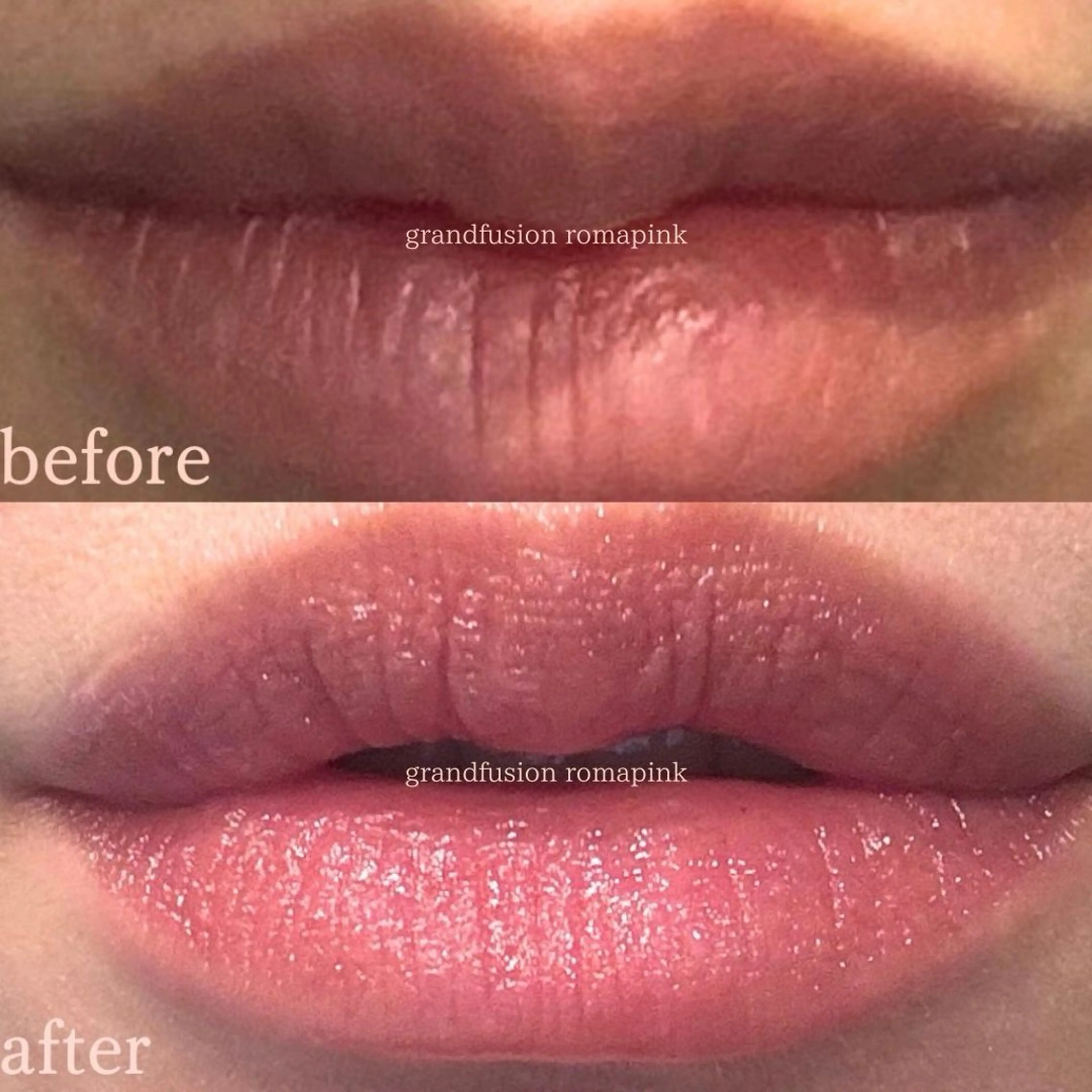 エステ Richeri 代官山のエステ・リラクイメージ