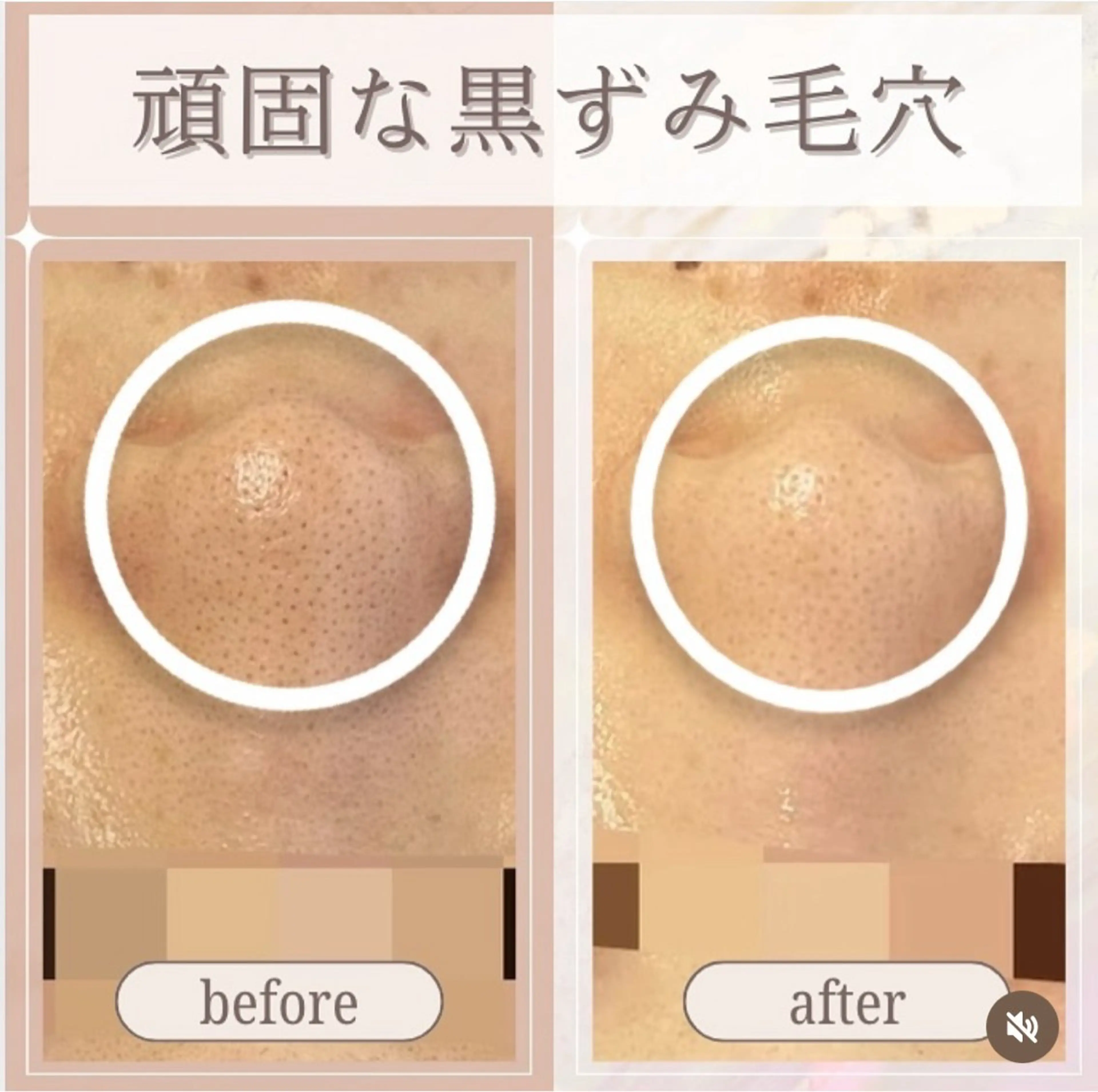 エステ 看護師が施術する ナスサロ/Emi🪽のエステ・リラクイメージ