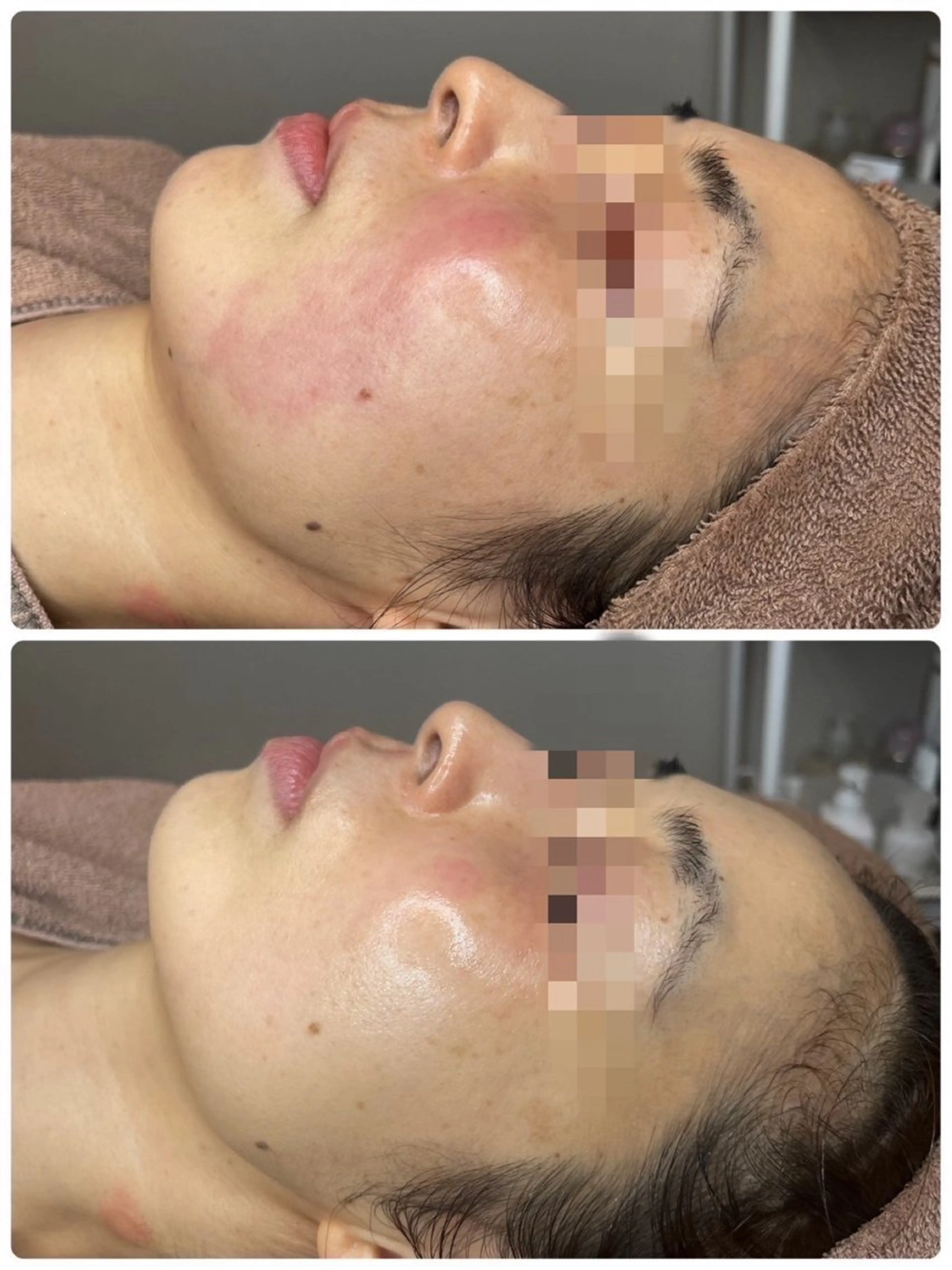 韓国no.1肌管理で即艶水光肌◎の写真