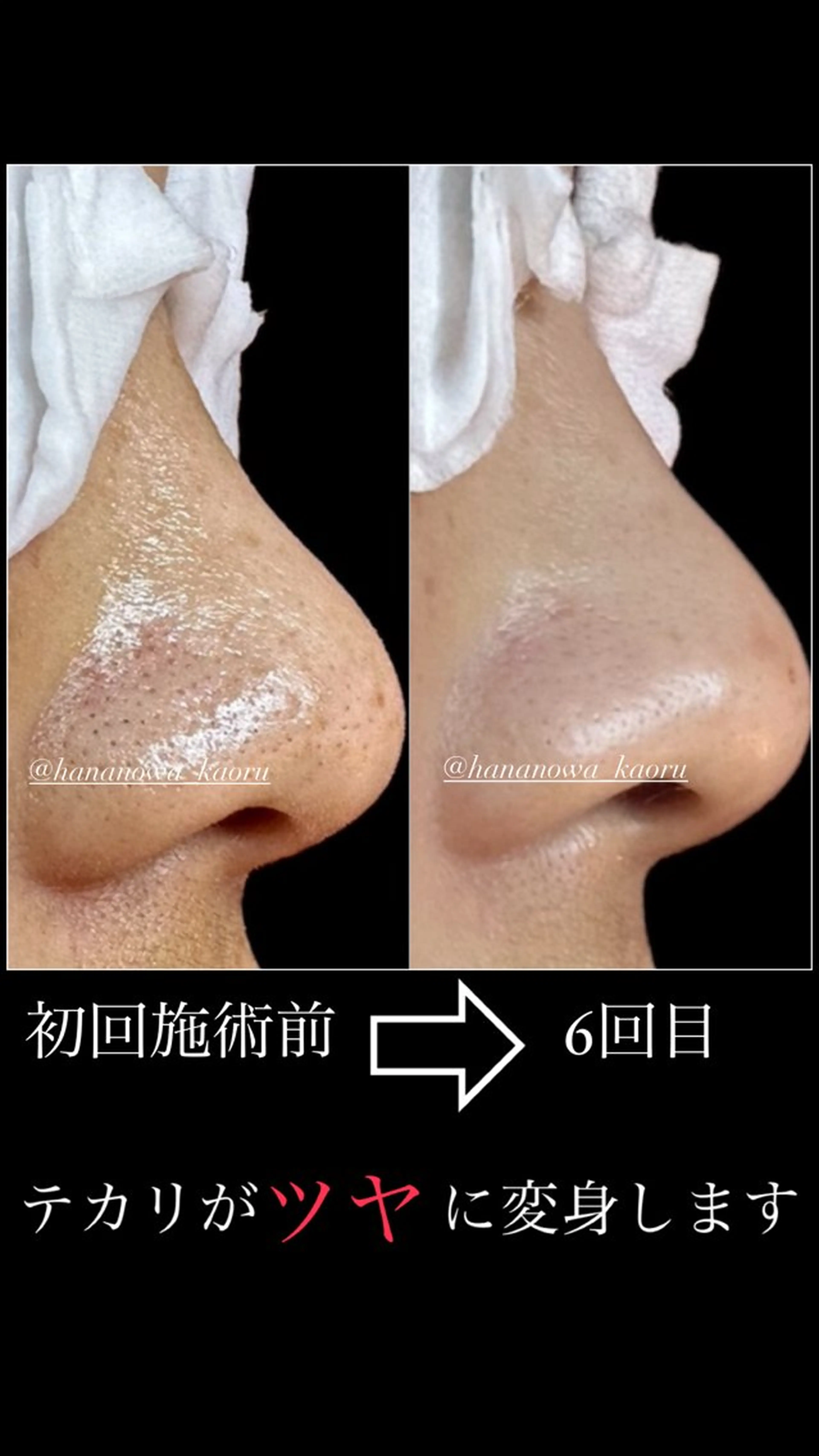 エステ リラク 毛穴&リンパマッサージ専門サロン 花のWA所属・毛穴&リンパマッサー ジ専門サロン花のWAのエステ・リラクイメージ