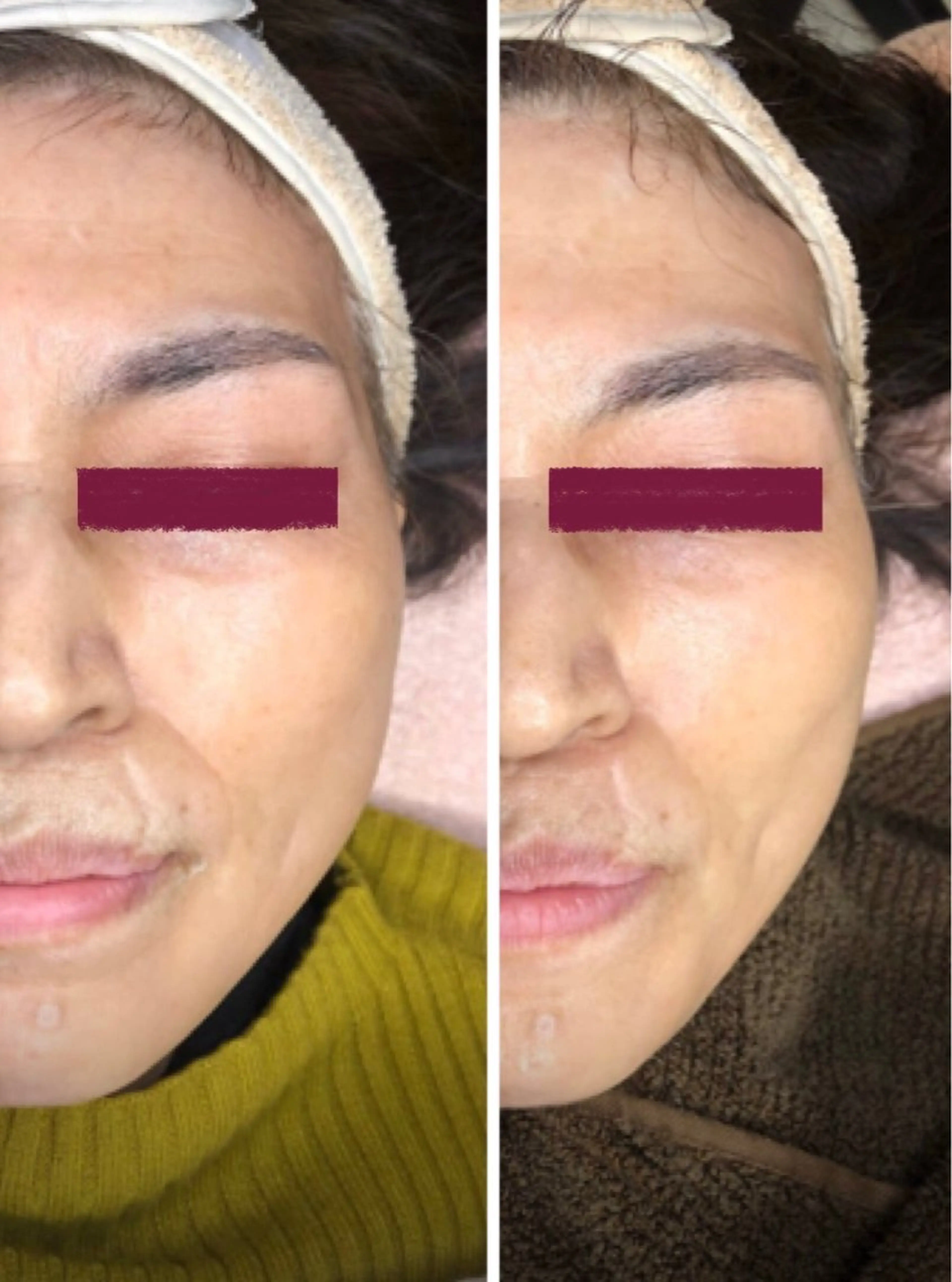 かすがい鍼灸院Re.heart所属・かすがい鍼灸院 Re.heartのエステ・リラクイメージ