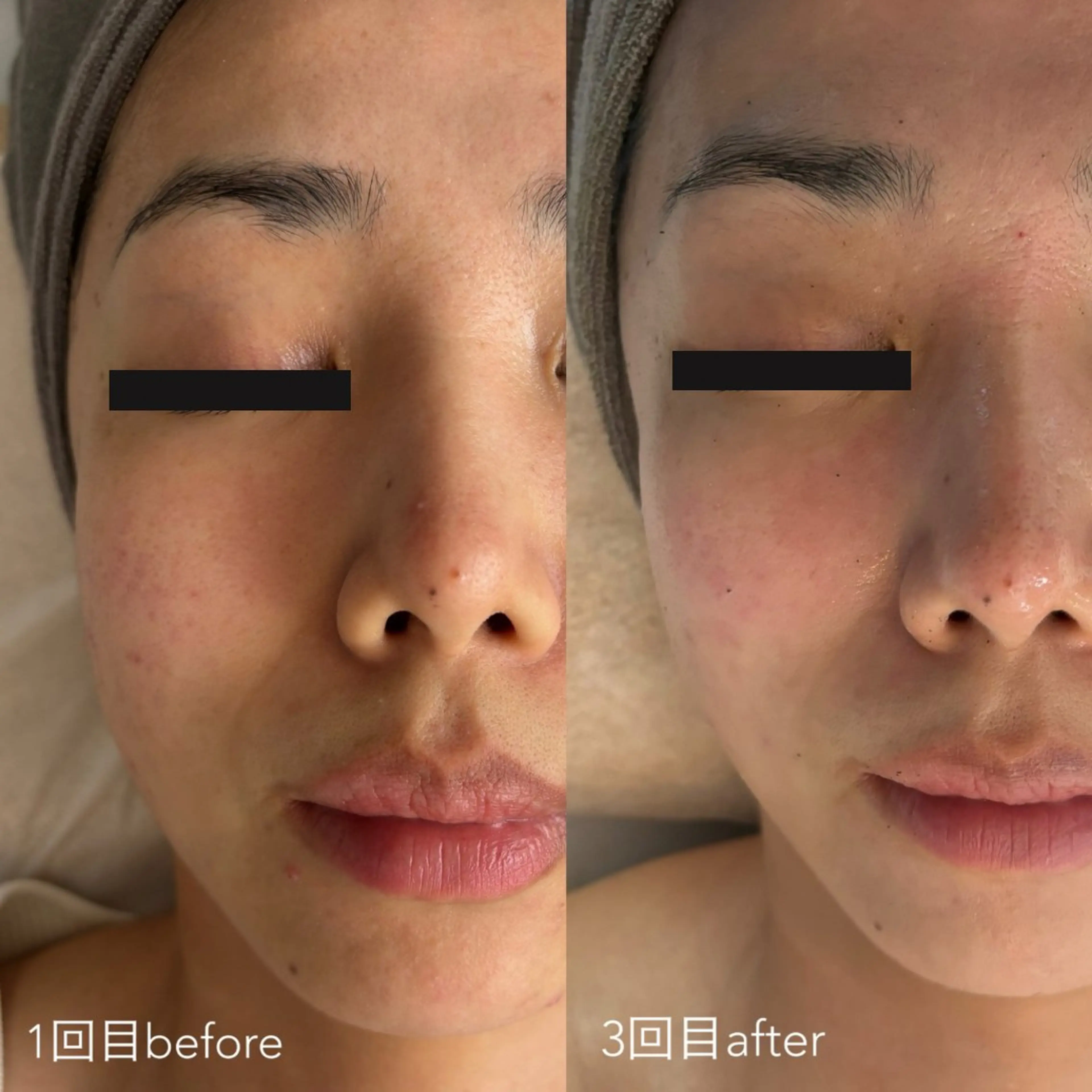 エステティックサロン Liente(リアンテ)所属・Hashimoto .のエステ・リラクイメージ