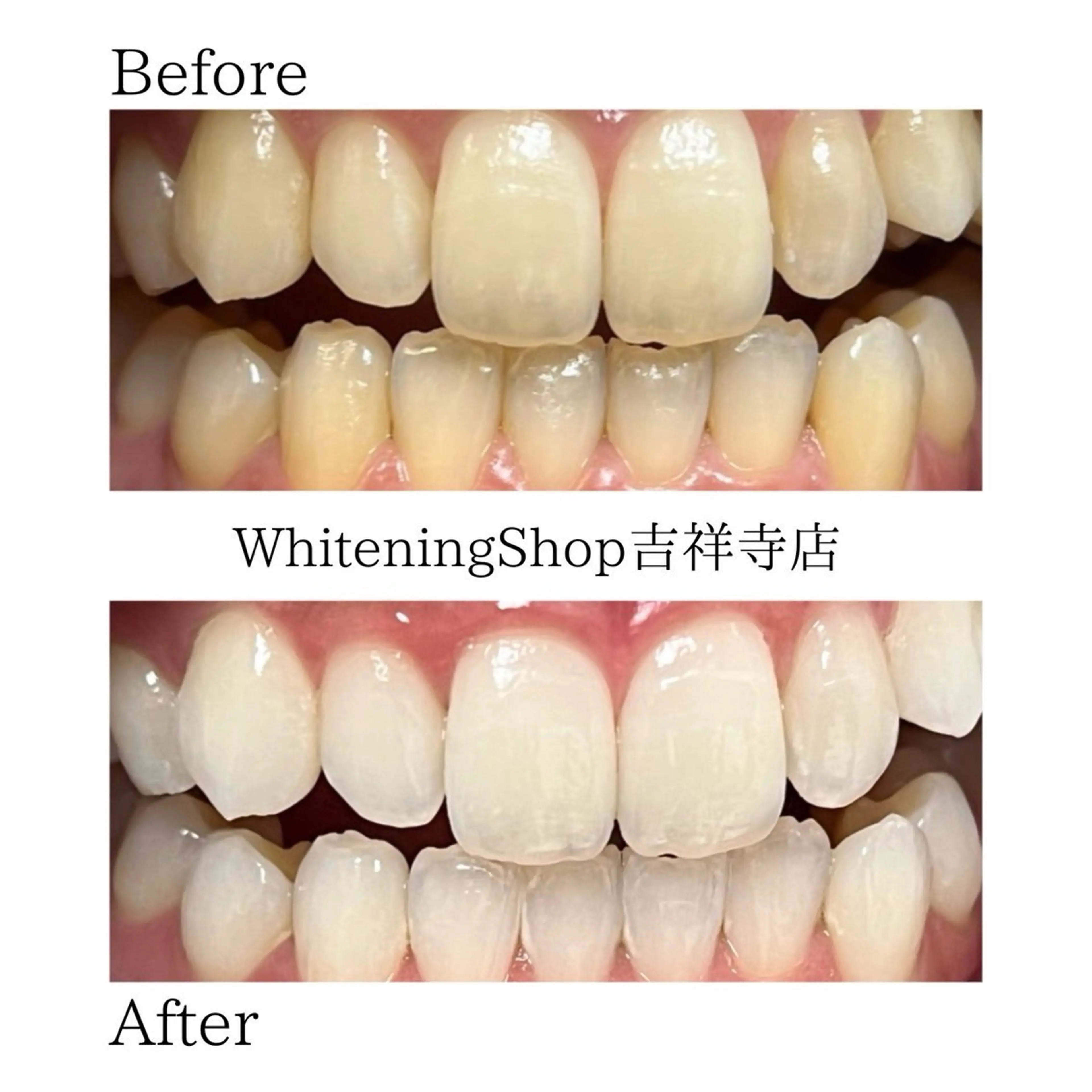 エステ リラク ホワイトニング ショップ吉祥寺店のエステ・リラクイメージ