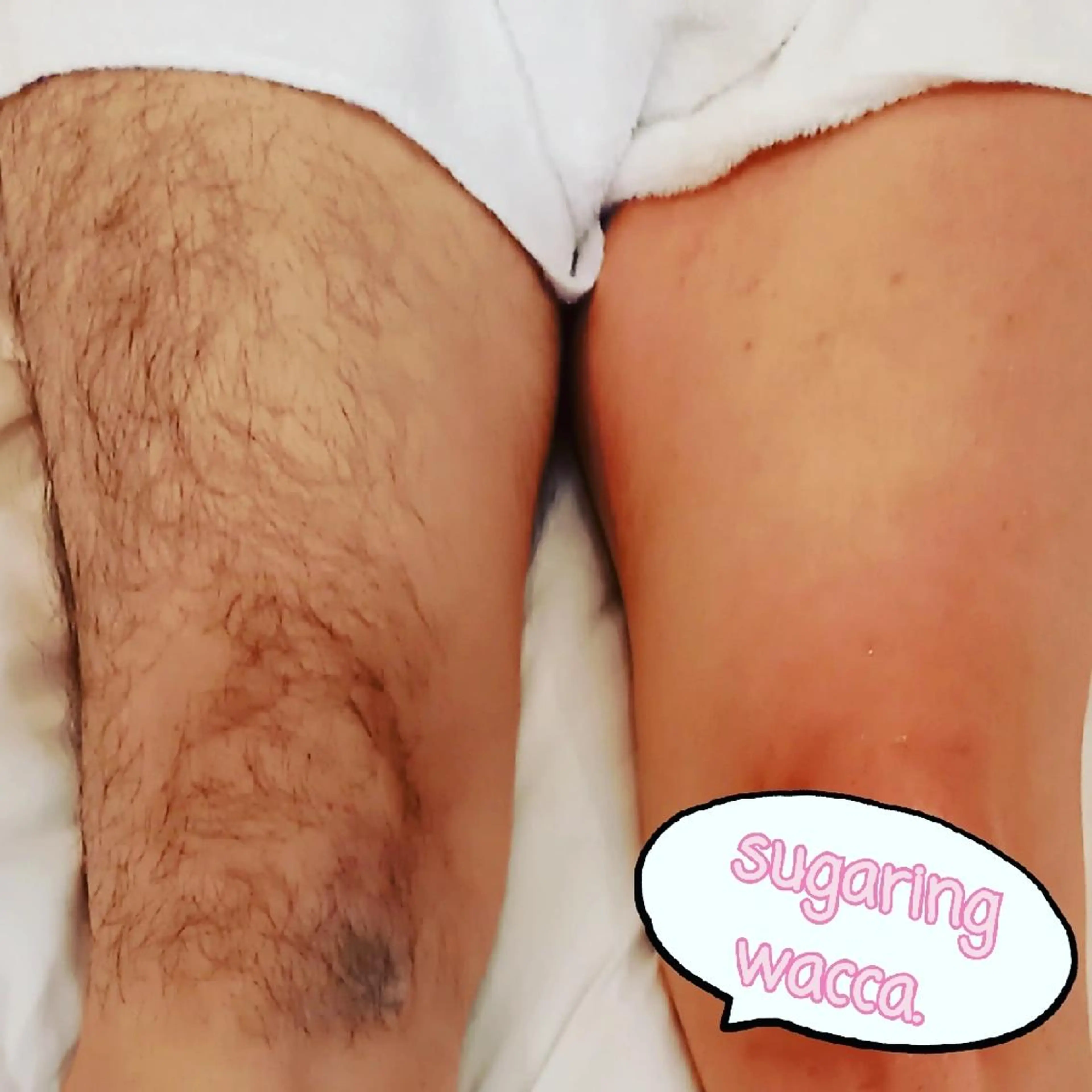 ↓↓↓↓↓メンズ脱毛メニューはこちらから↓↓↓↓↓の写真