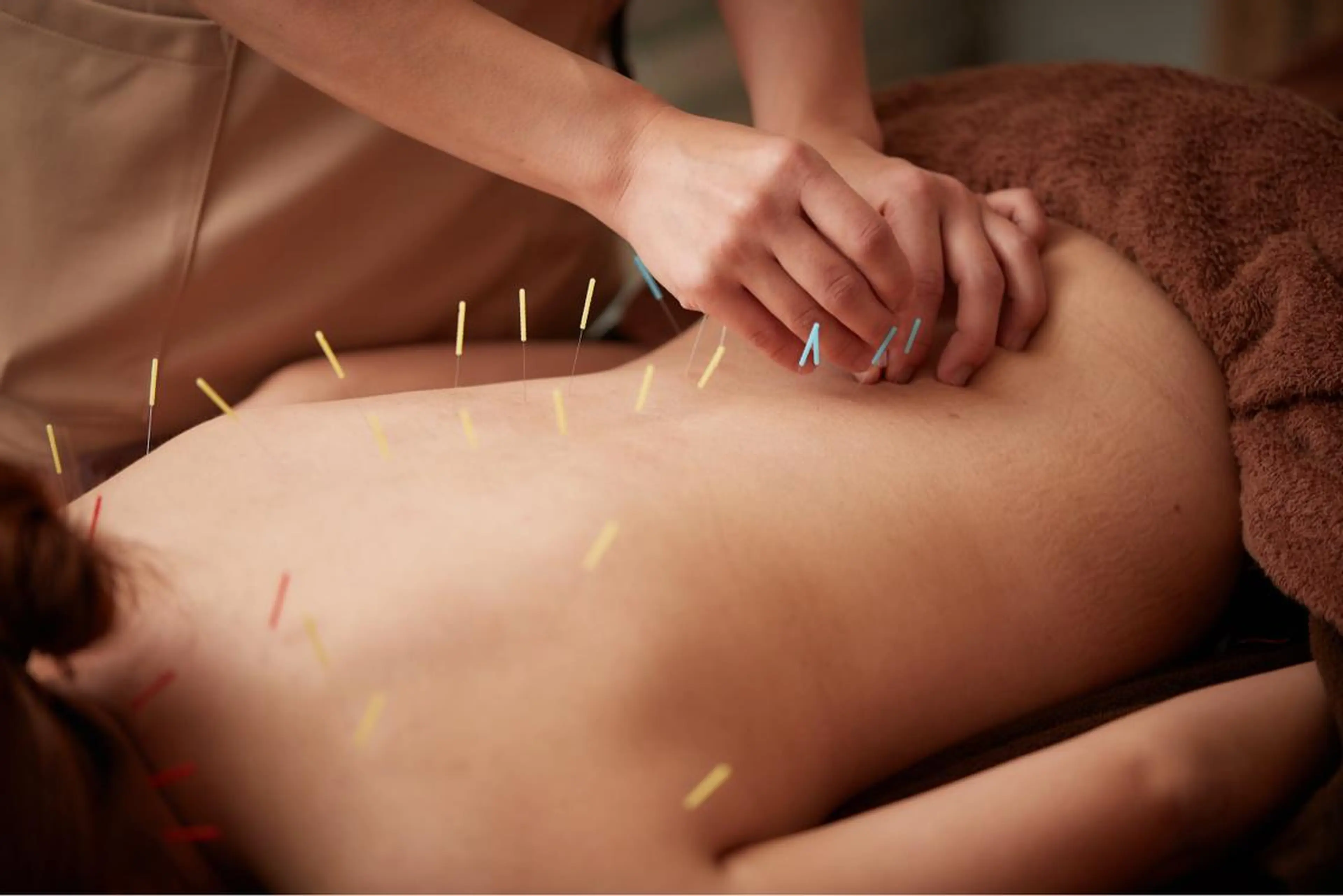 美楽鍼 びらくしんのその他イメージ