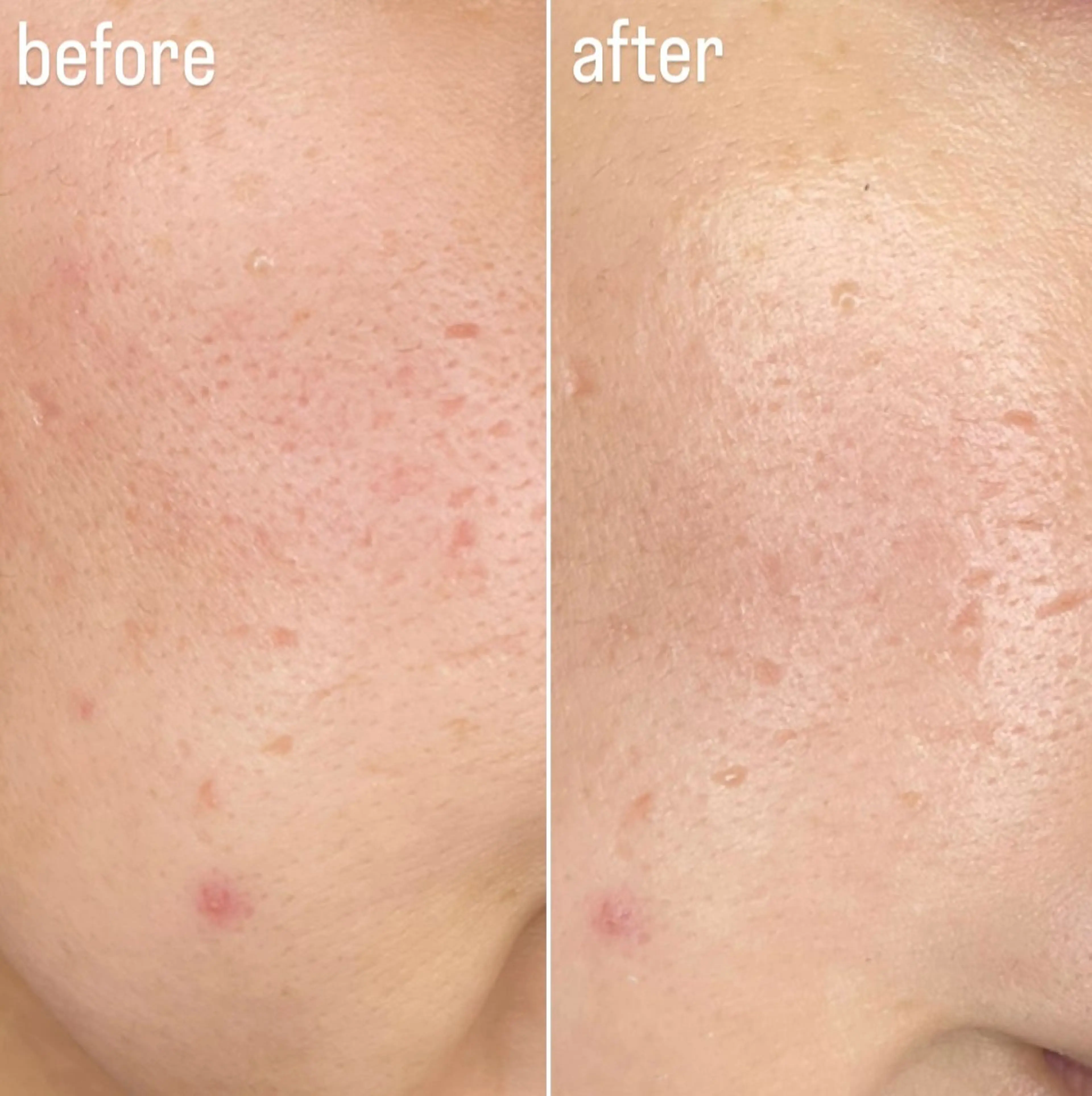 エステ Re Amply Minamiのエステ・リラクイメージ