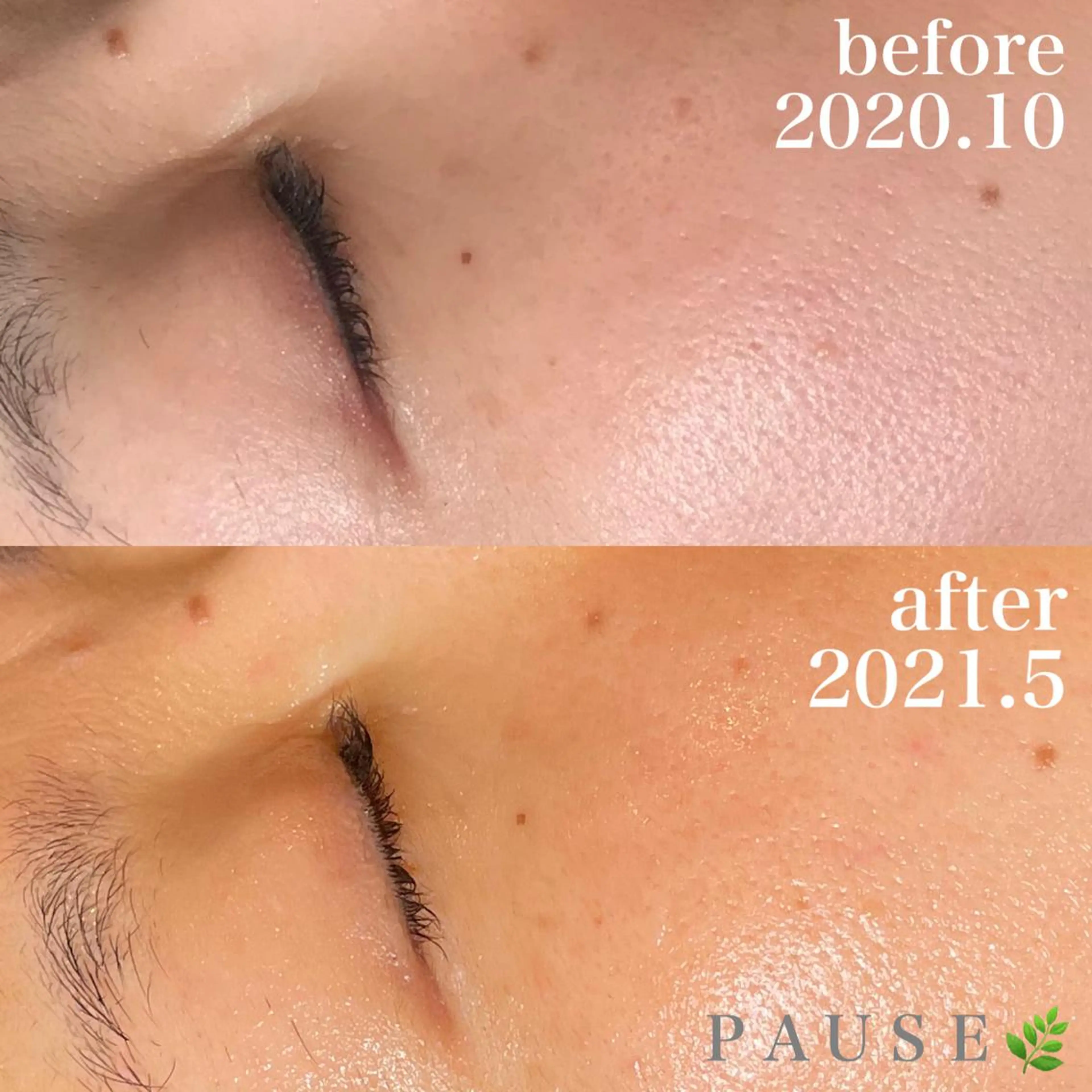 エステ 浜野 恵美のエステ・リラクイメージ