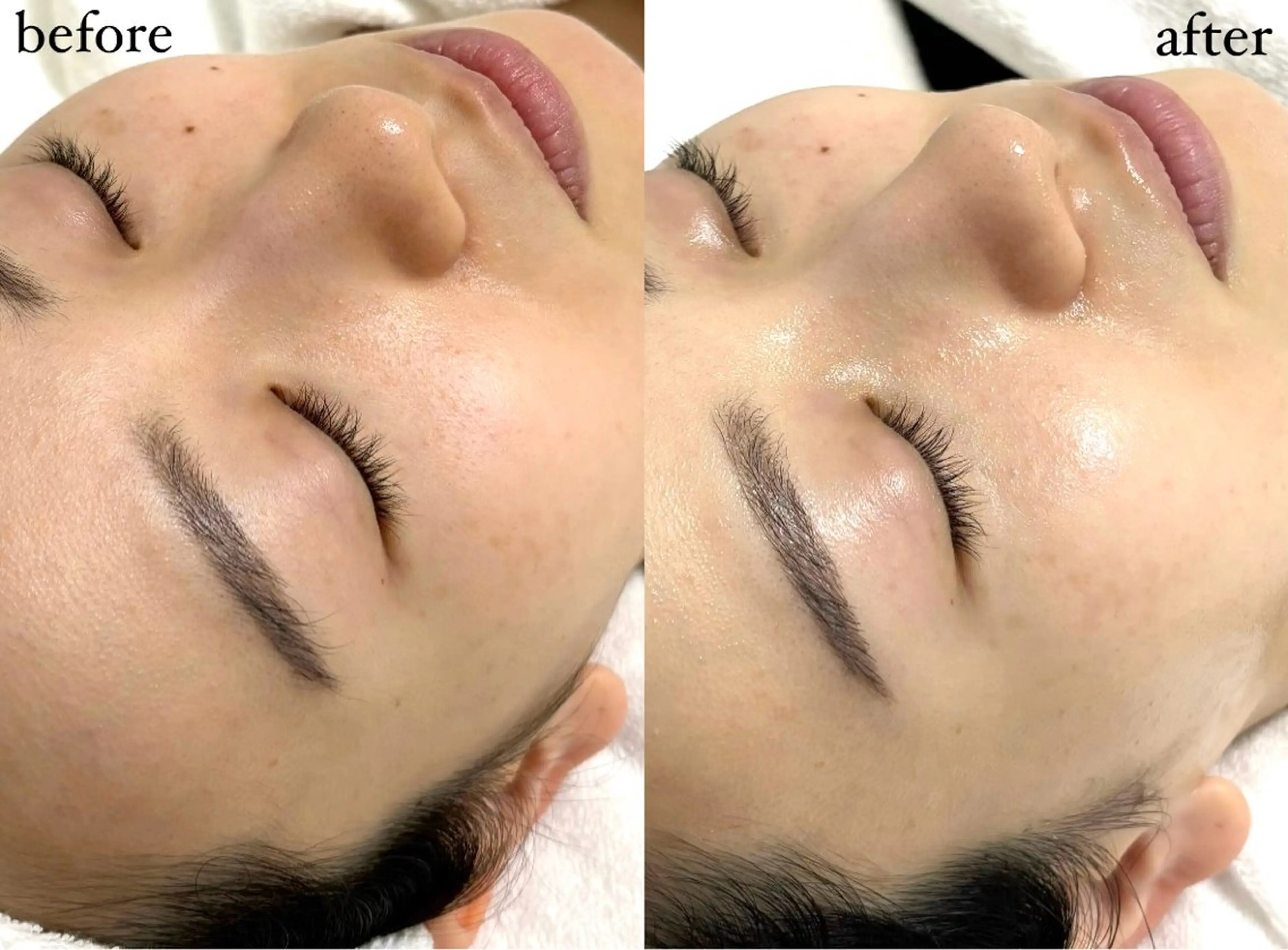 女性専門お顔剃り sunraineのエステ・リラクイメージ