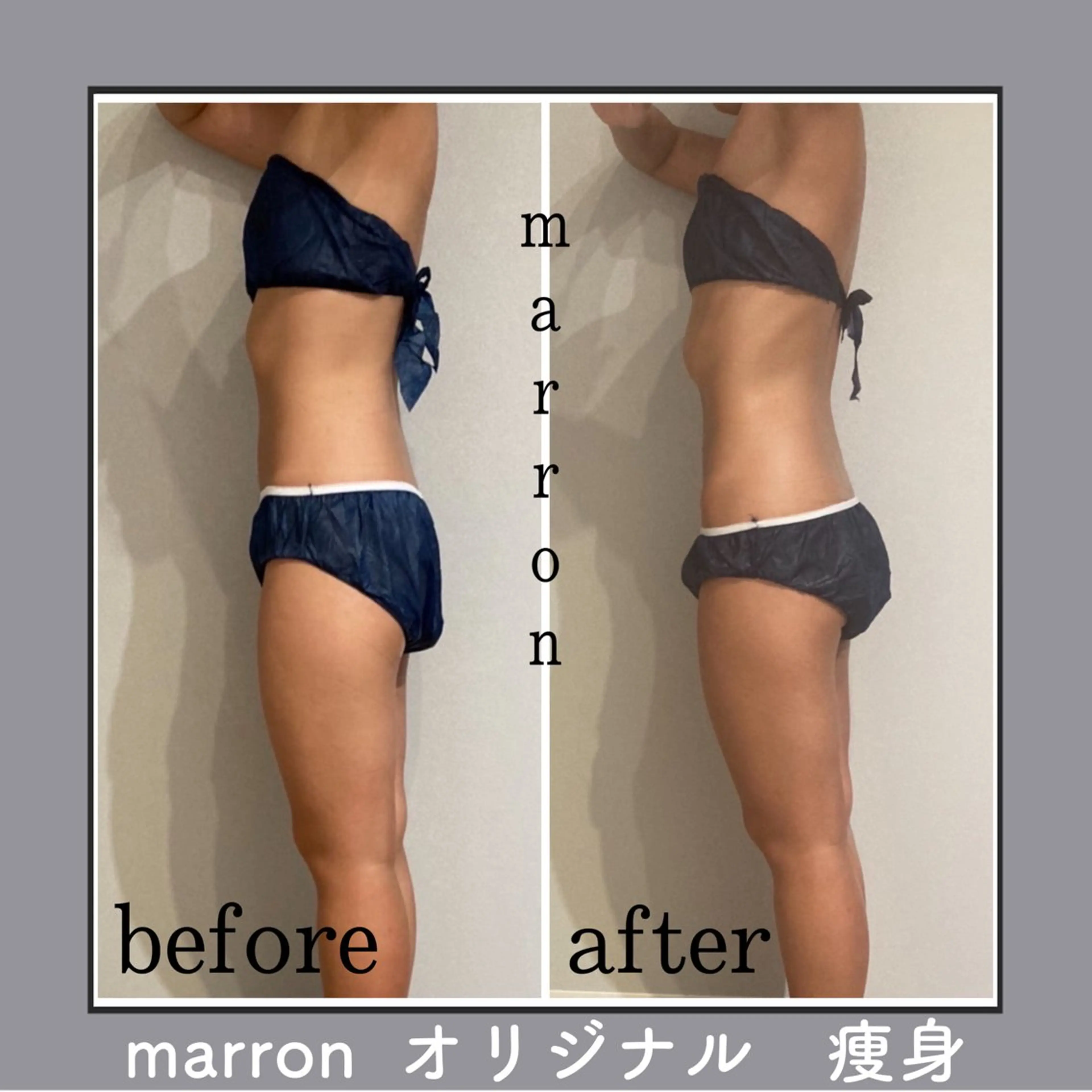 marron所属・痩身ハイパーナイフ ララピールリアボーテのエステ・リラクイメージ