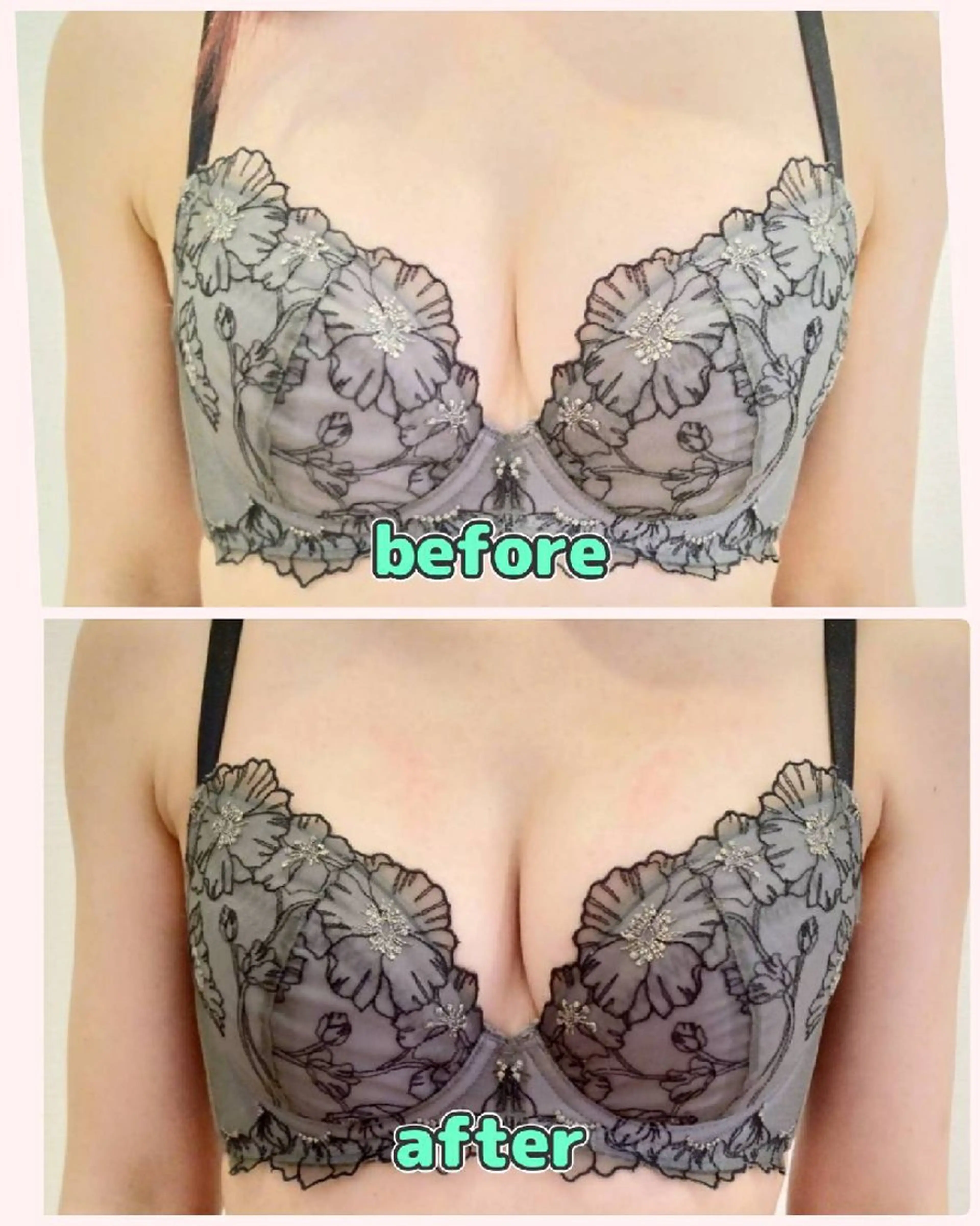 マシュマロバストマッサージ+うる艶アップ光照射の写真