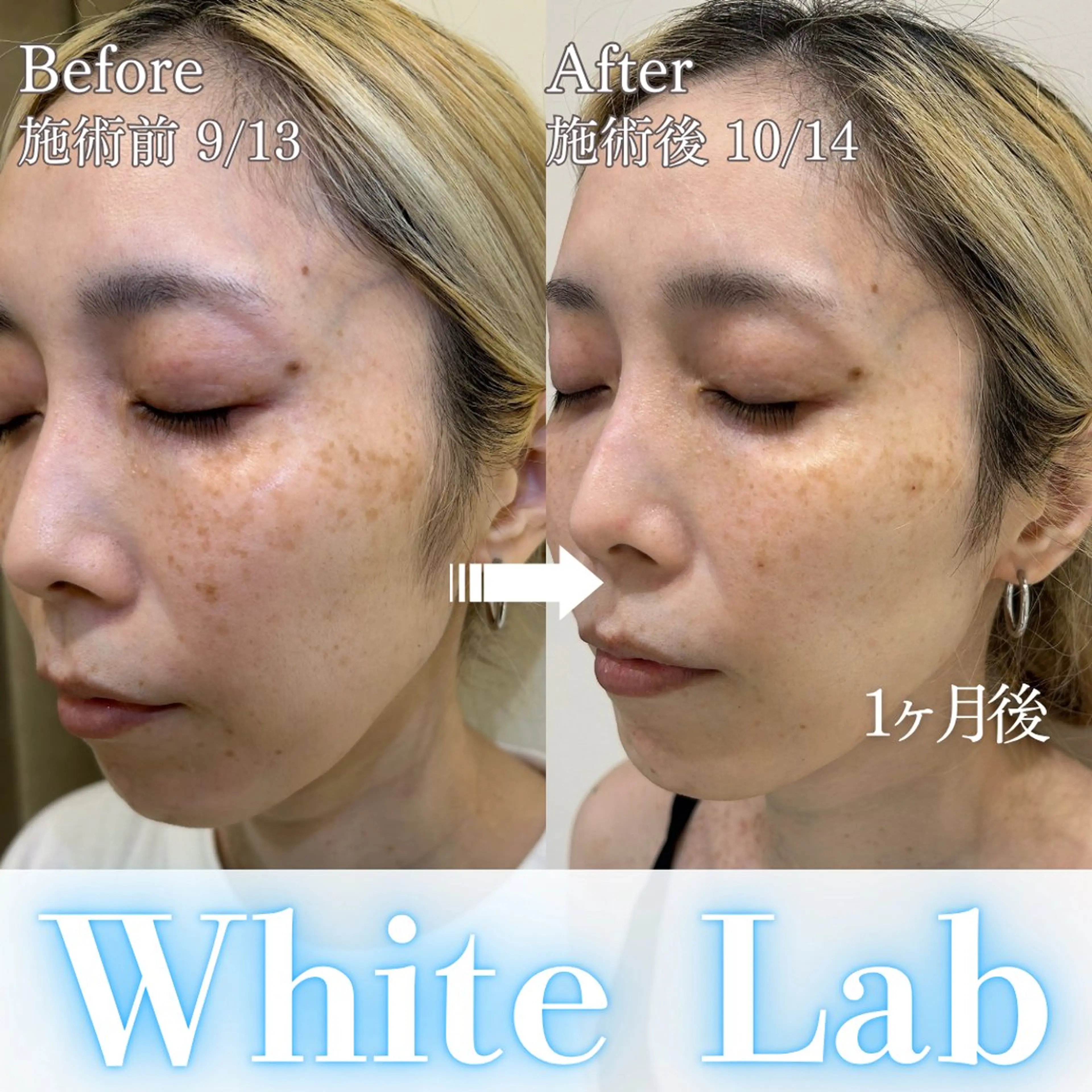 エステ Salon ALLIUM 恵比寿のエステ・リラクイメージ