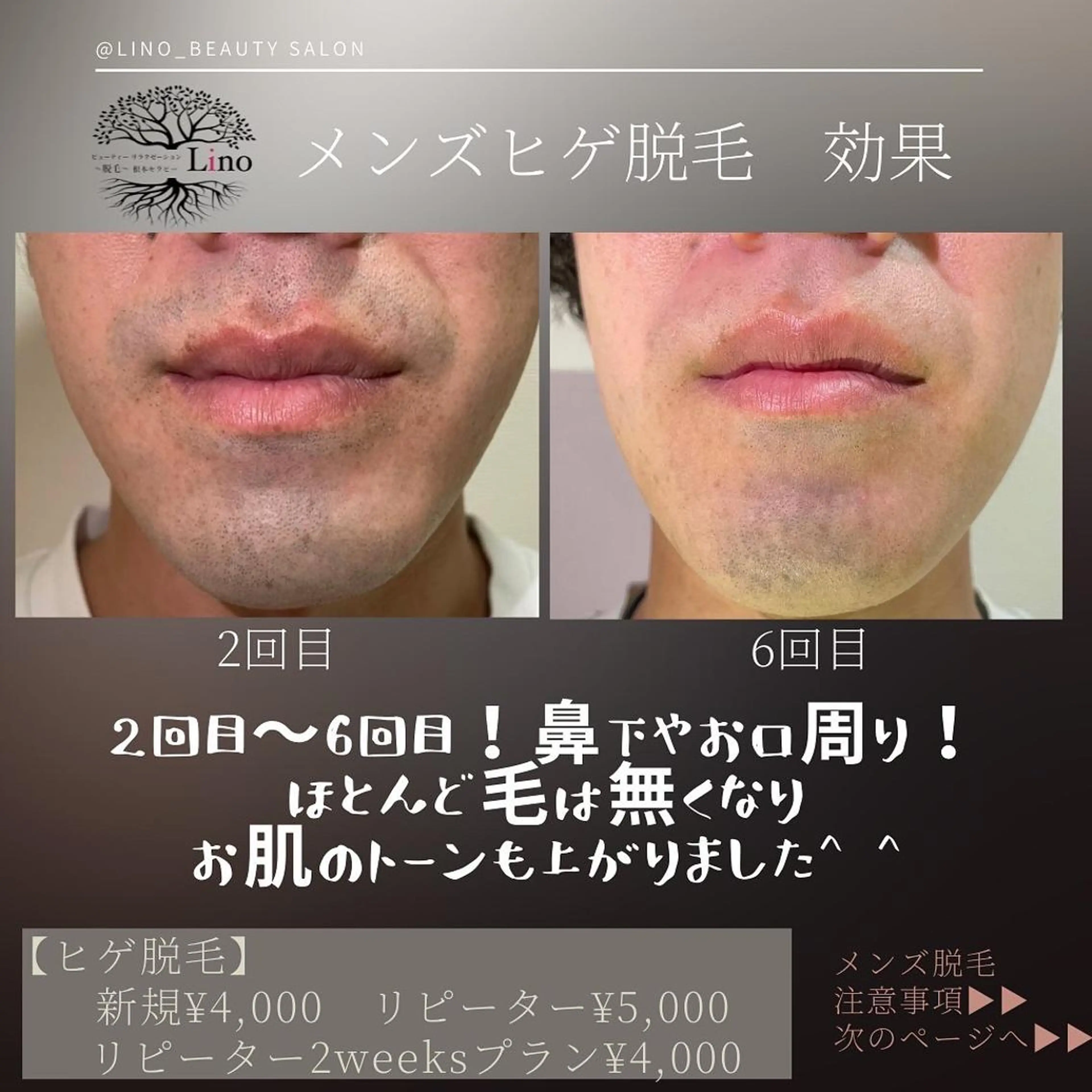 メンズ マツエク・マツパ Lino 《リノ》のエステ・リラクイメージ