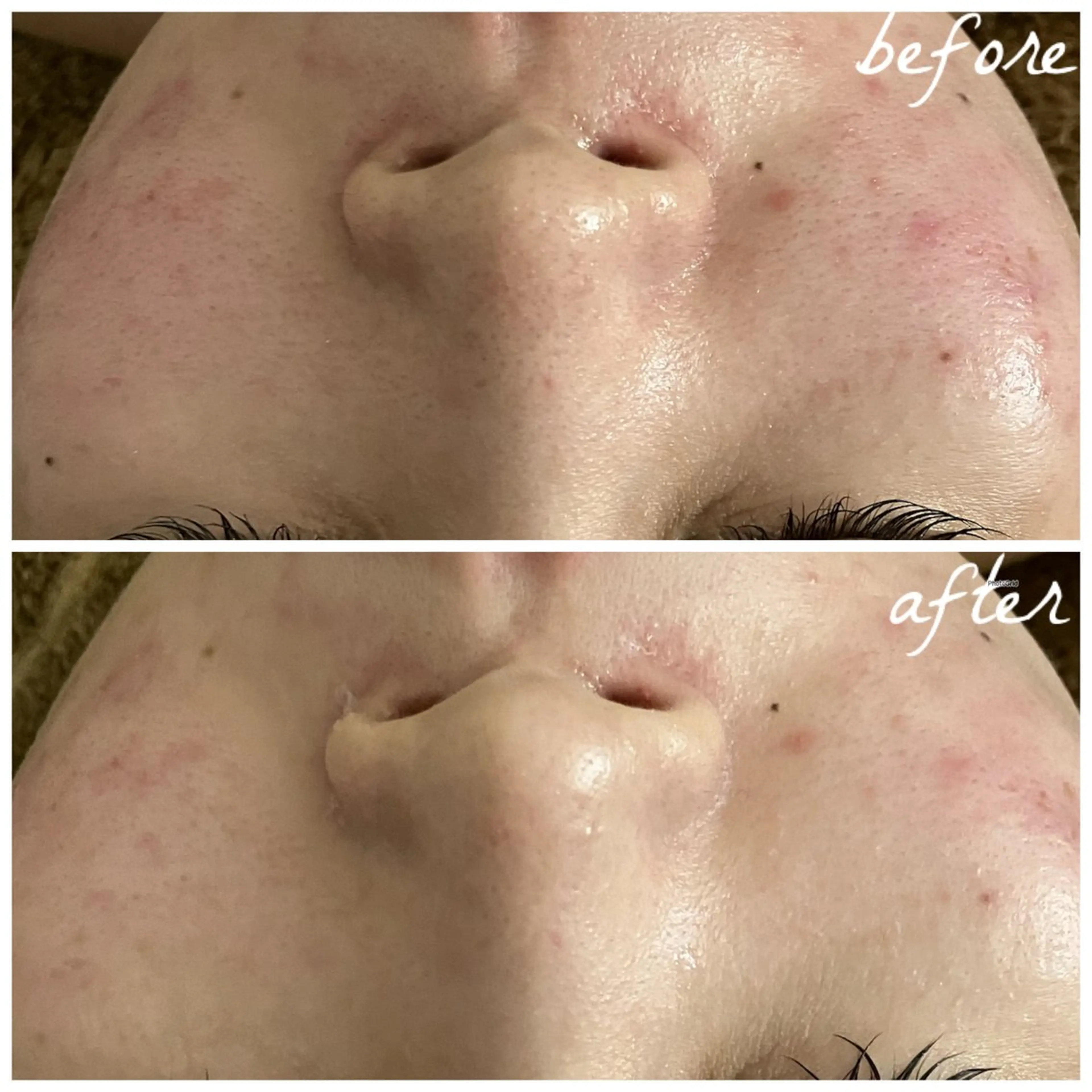 メンズ エステ メナード岐阜茜部 杉浦のエステ・リラクイメージ