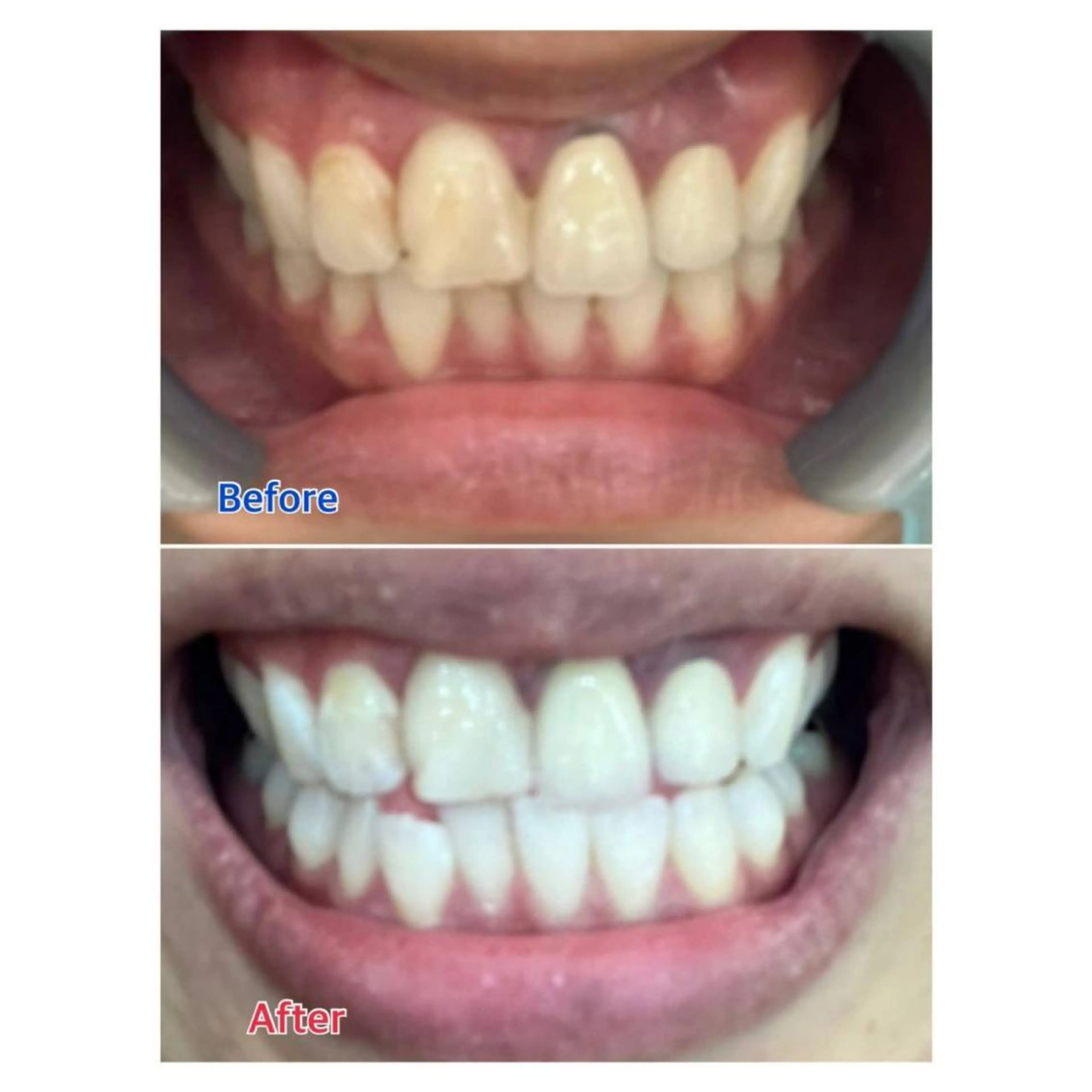 MBEAUTYSALON 千葉店・京成大久保所属・Melty 輝のその他イメージ