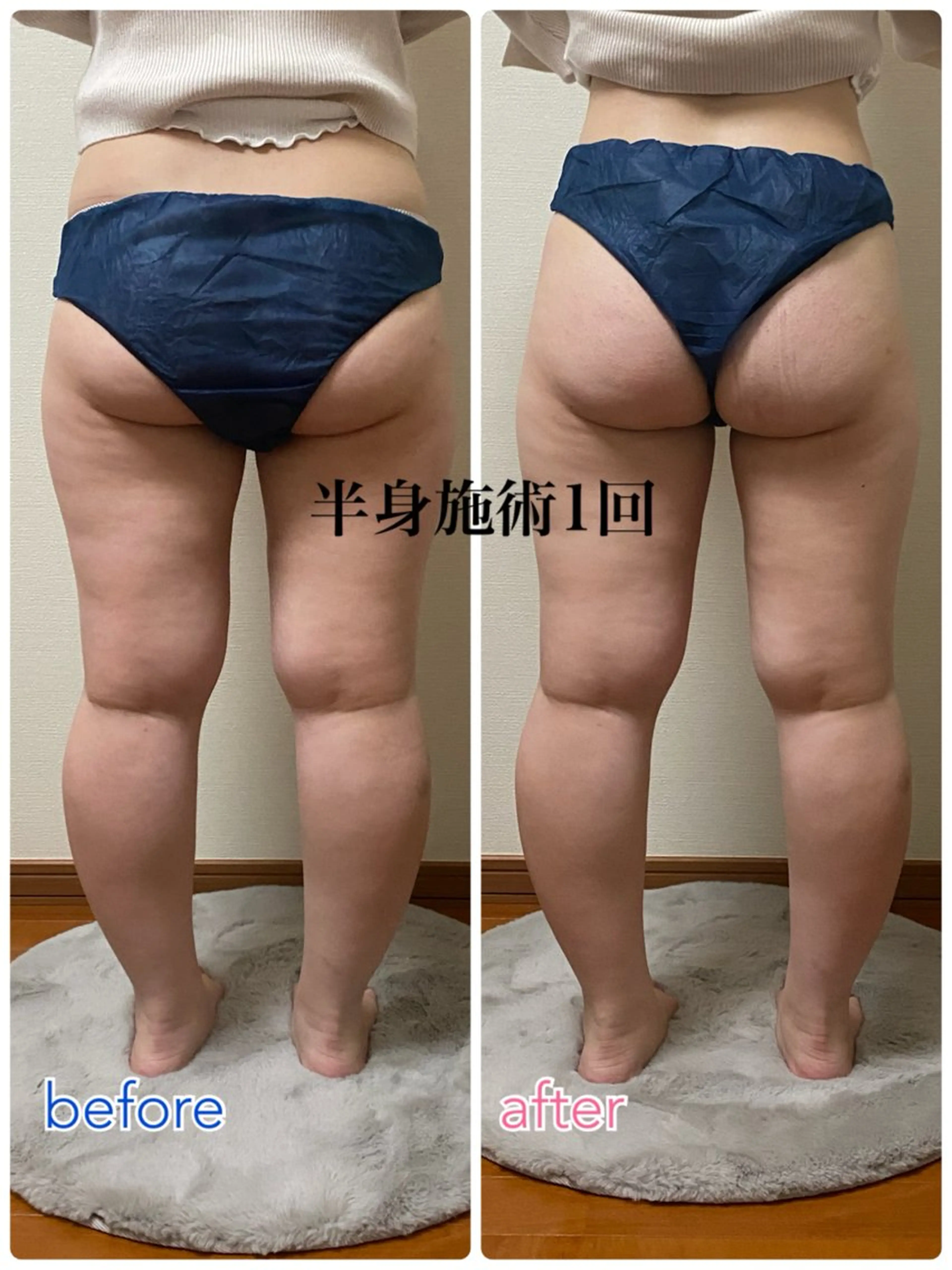 エステ ACORAL痩身 NAZUKIのエステ・リラクイメージ