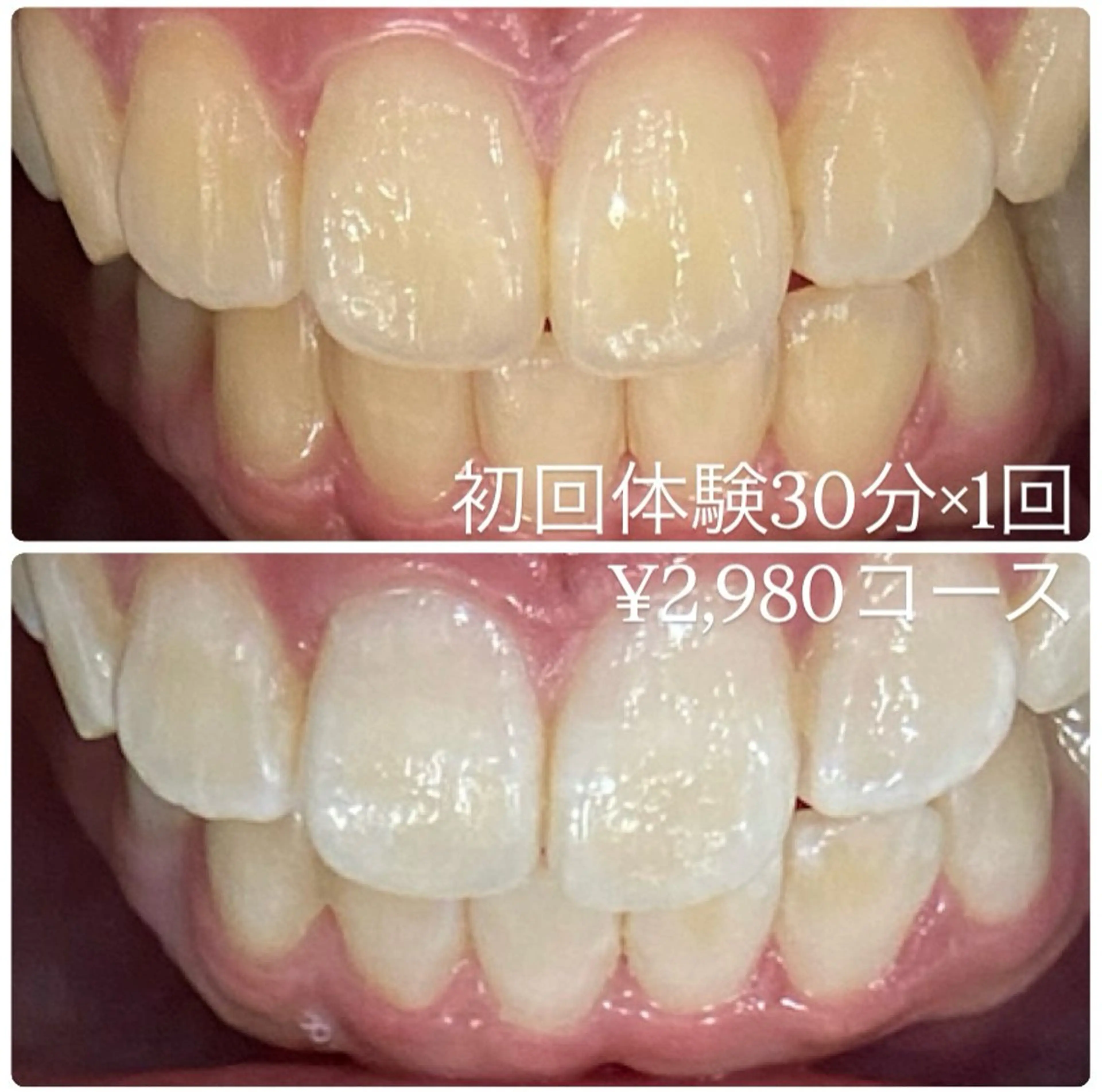 PLATINUM Beauty 横浜店所属・ホワイトニングルーム 横浜店のその他イメージ