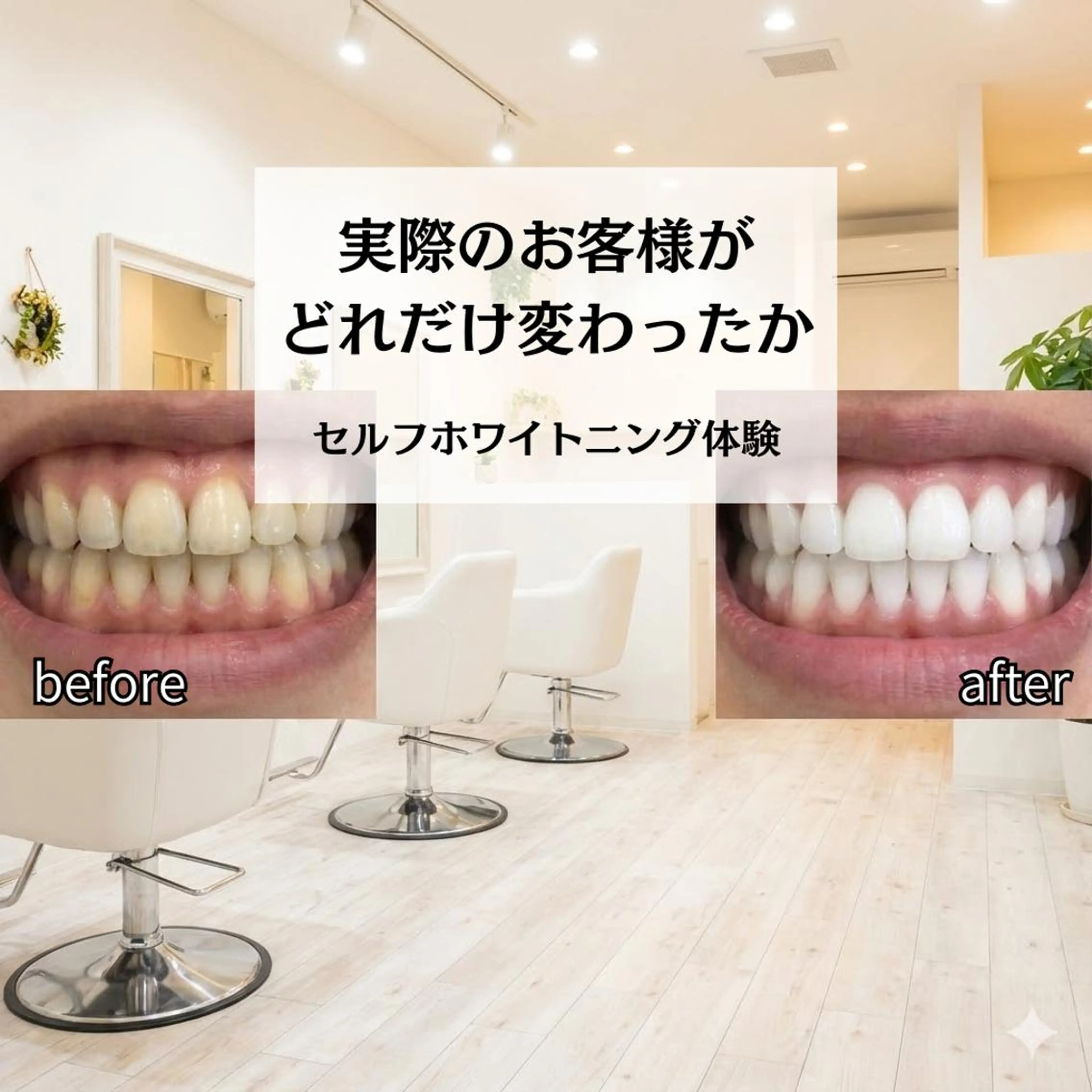 セミロング キッズ その他 ホワイトニングサロン nico西葛西店のその他イメージ