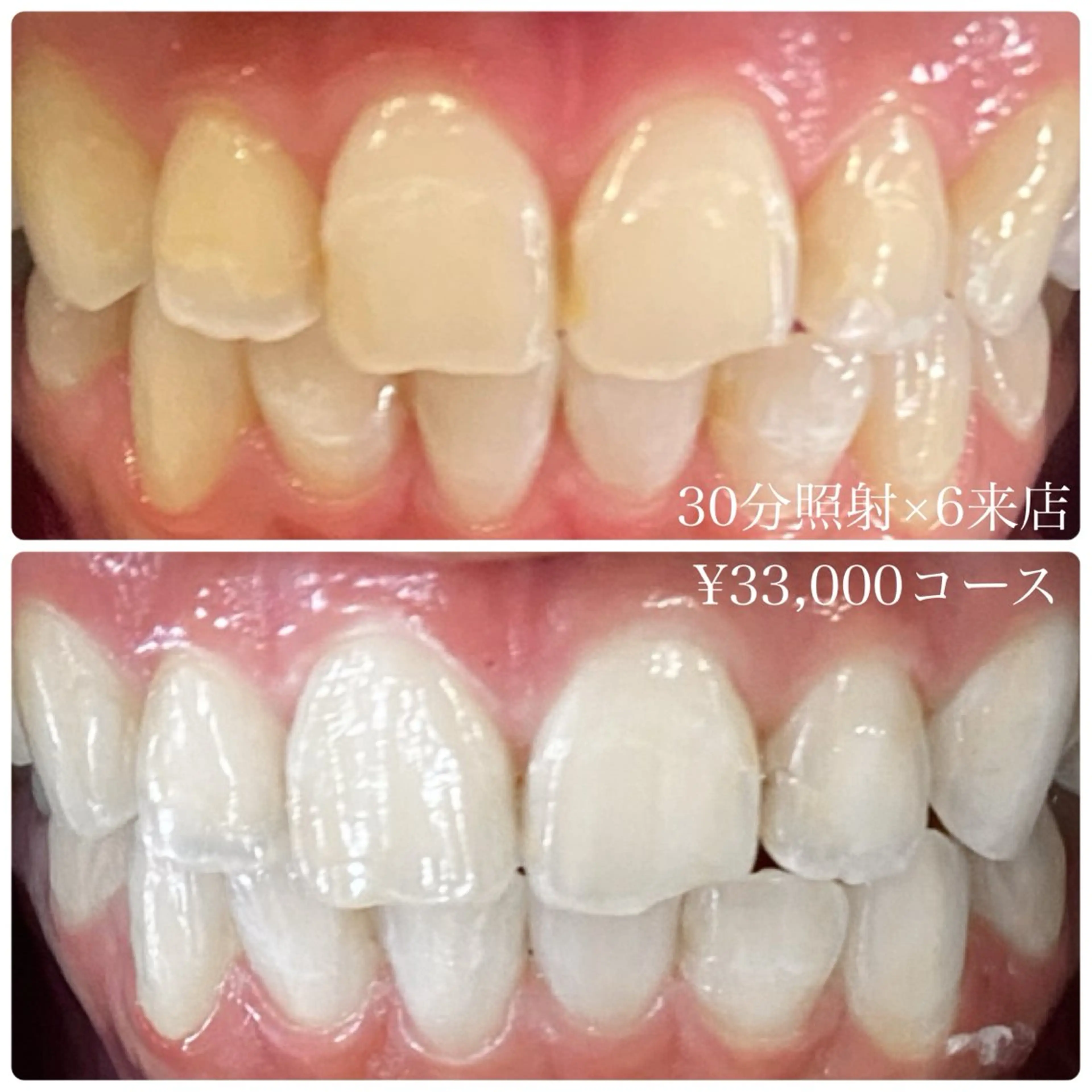 メンズ その他 ホワイトニングルーム　川崎店所属・ホワイトニング ルーム　川崎店のその他イメージ