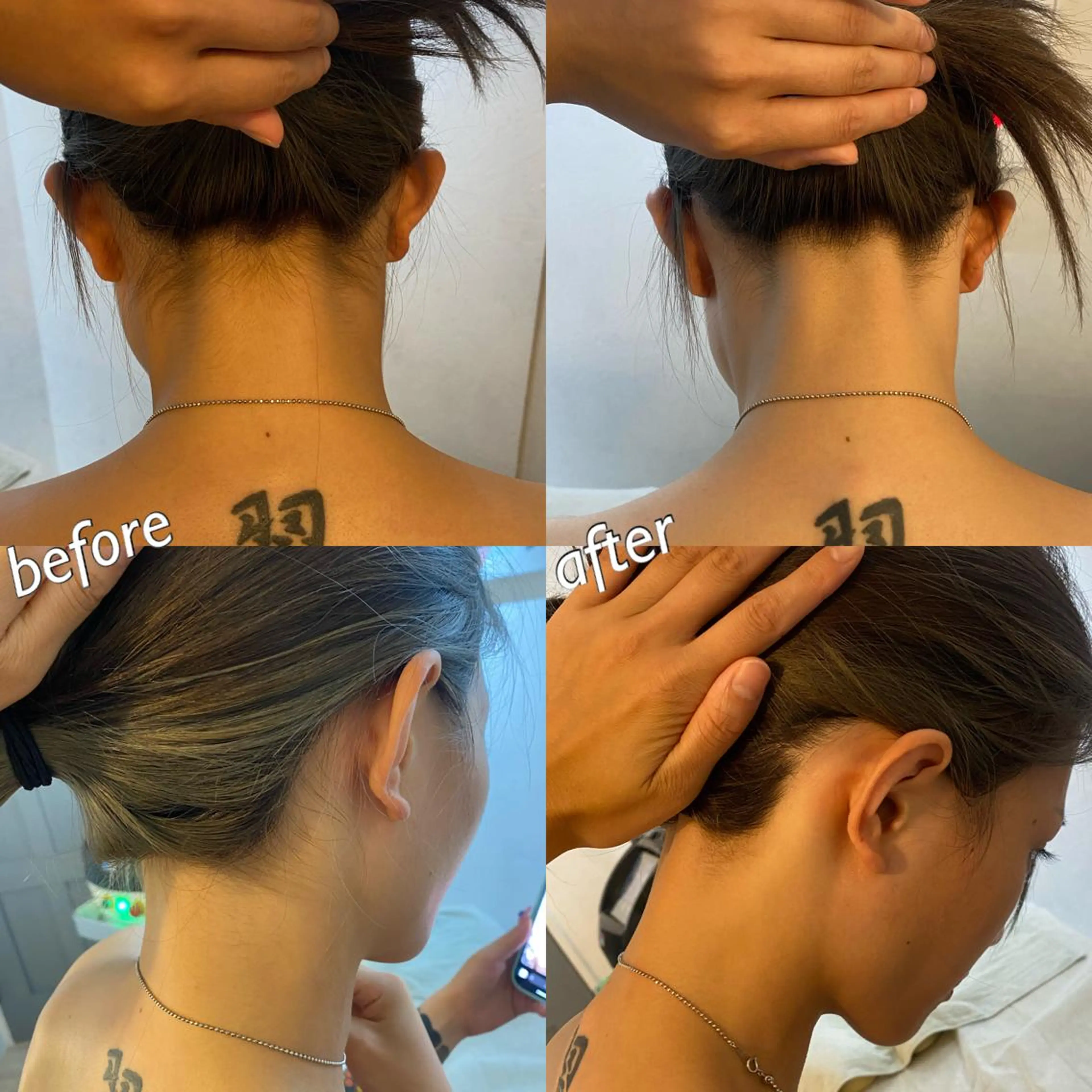 うなじ脱毛/美肌脱毛 LABELのエステ・リラクイメージ