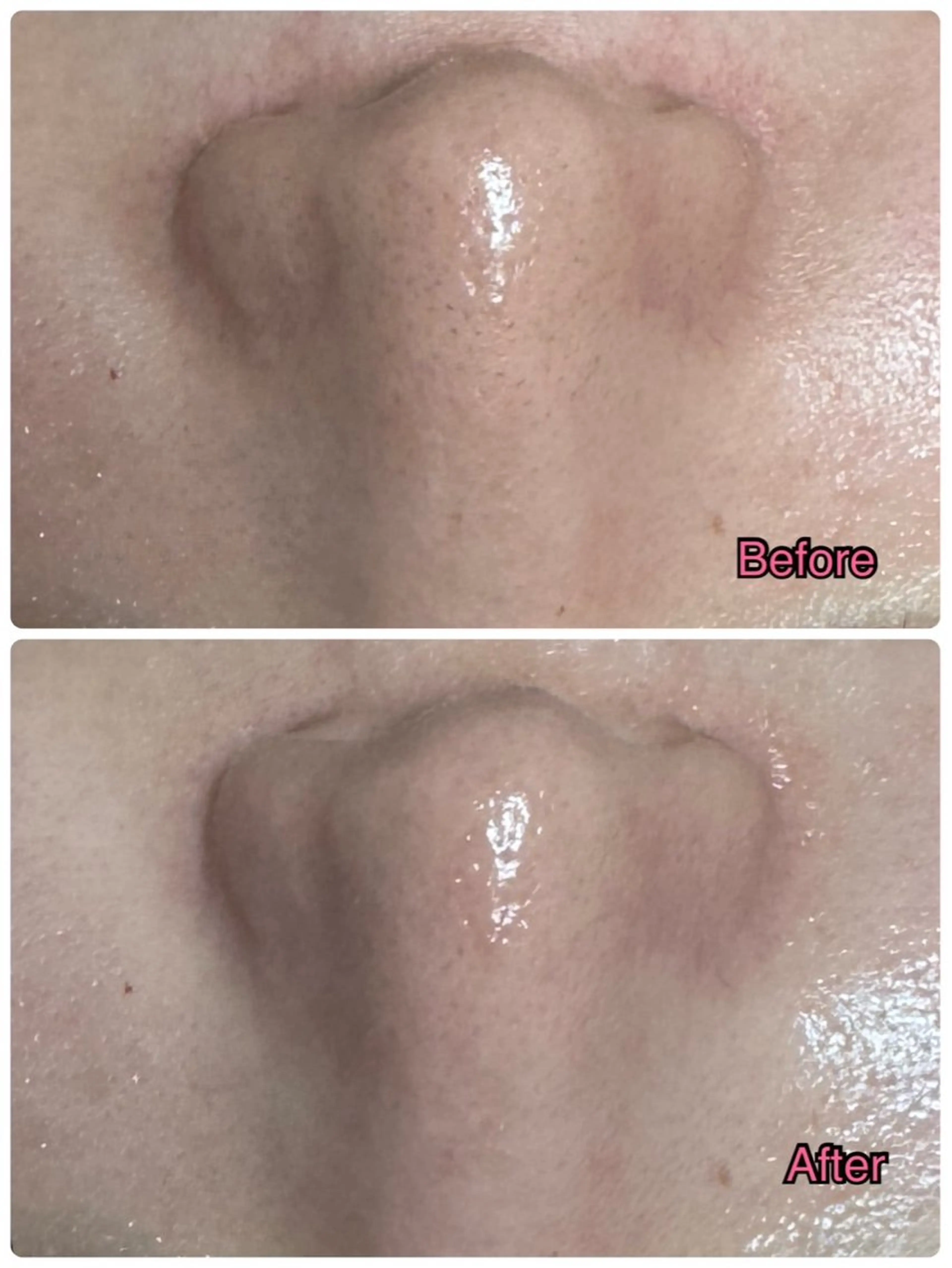 ☆大人気☆毛穴洗浄 エステブリランテのエステ・リラクイメージ