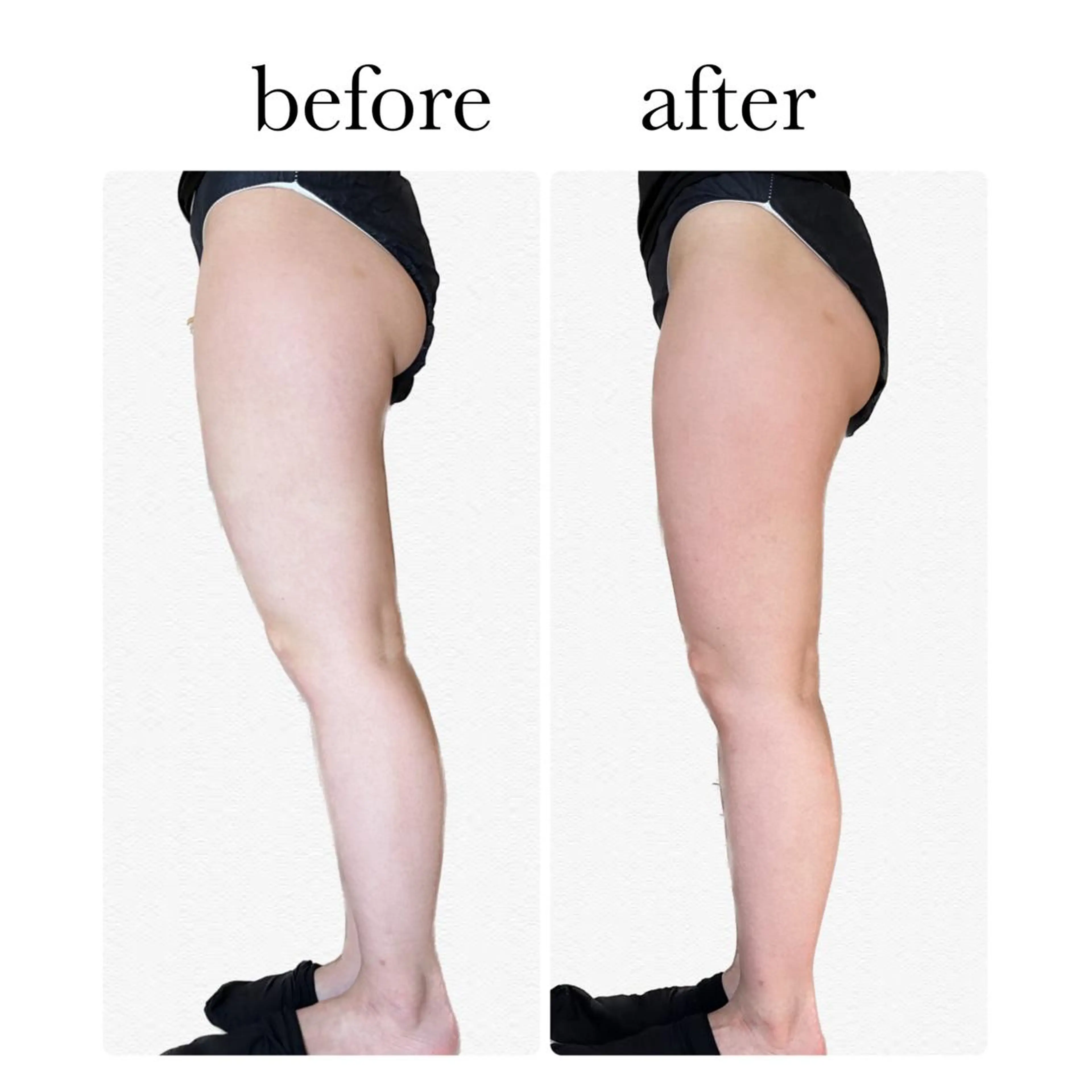 stella所属・stella都度払い 痩身小顔まつげパーマのマツエク・マツパデザイン