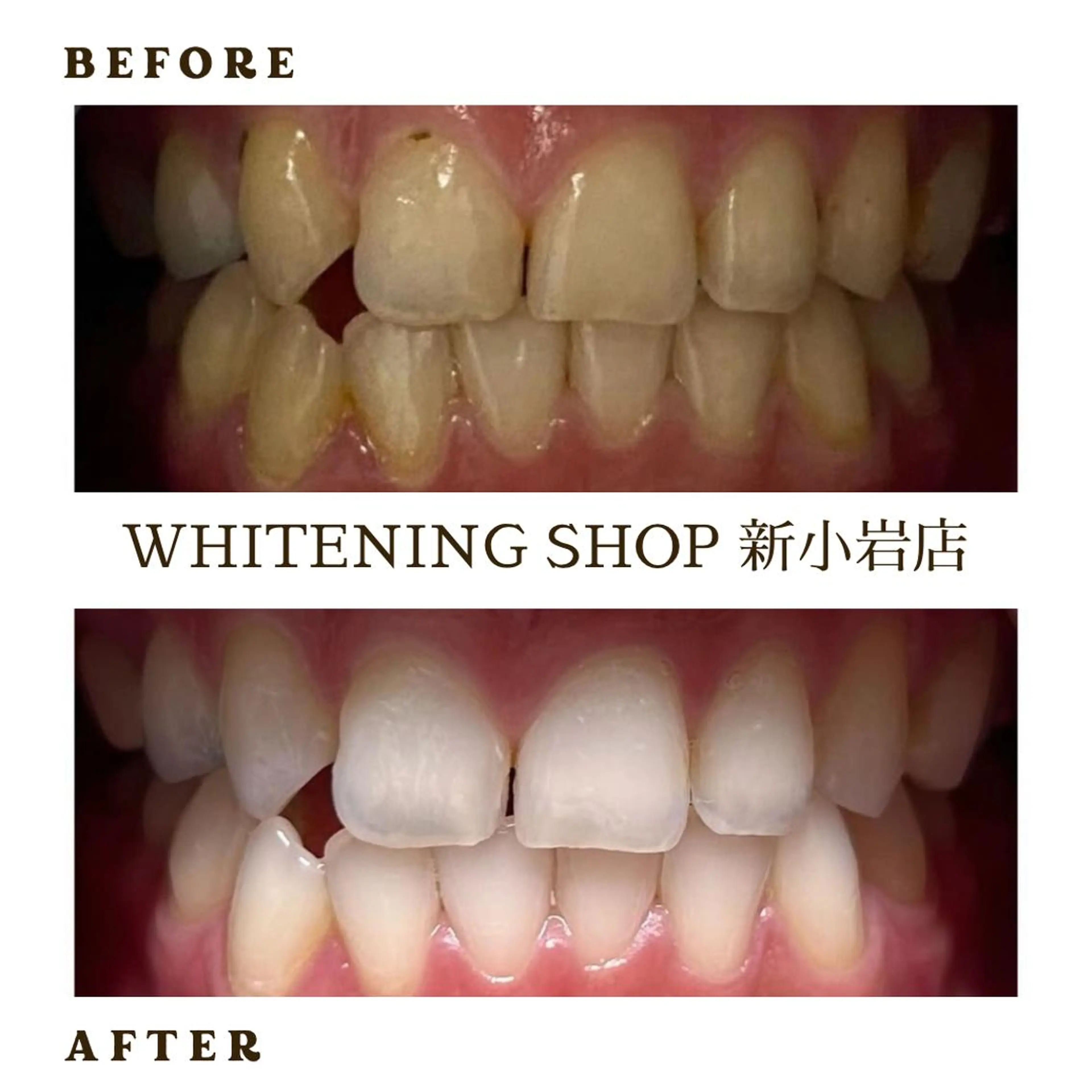 メンズ その他 ホワイトニング ショップ新小岩店のその他イメージ