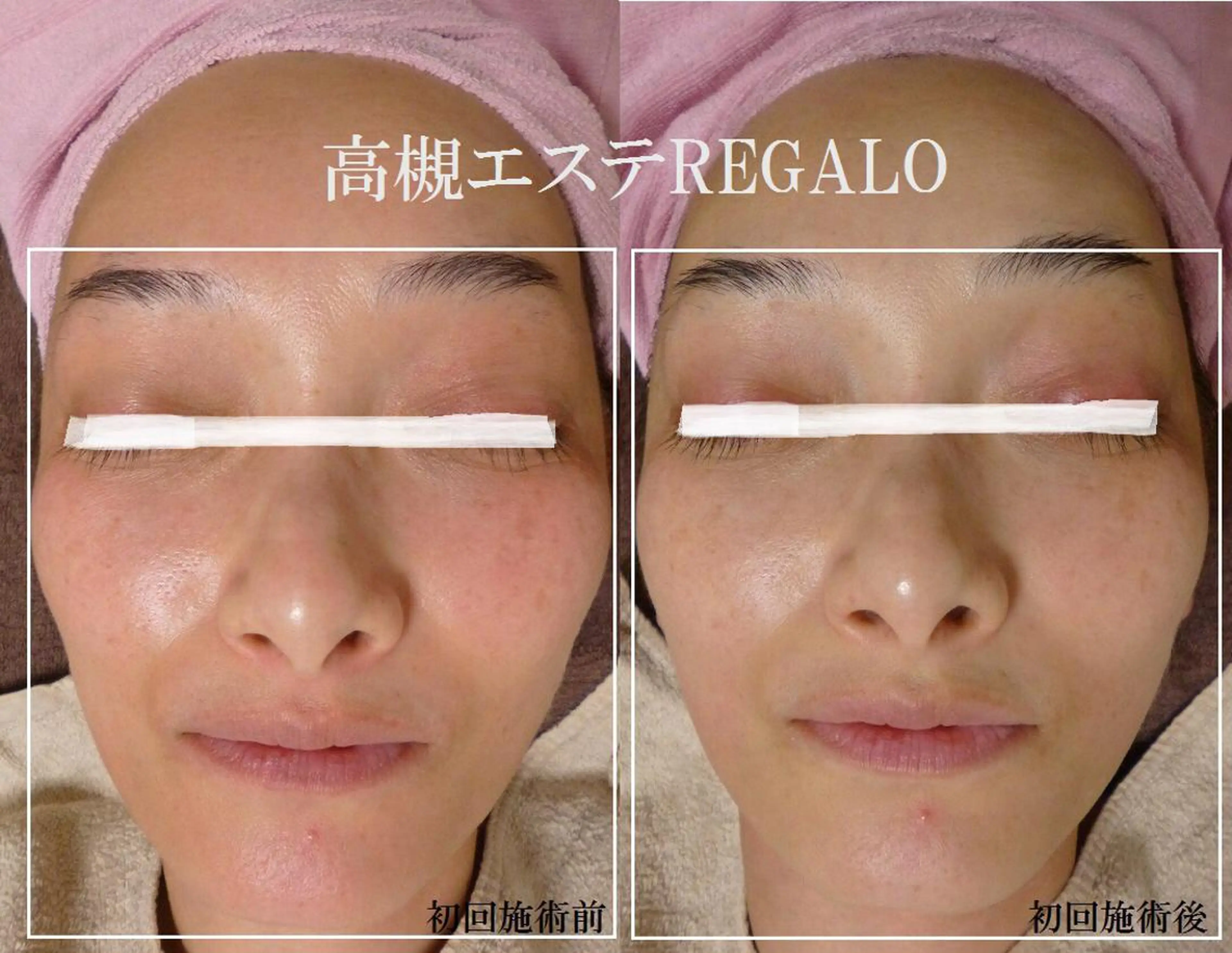 エステ REGALO所属・矢野 さやかのエステ・リラクイメージ