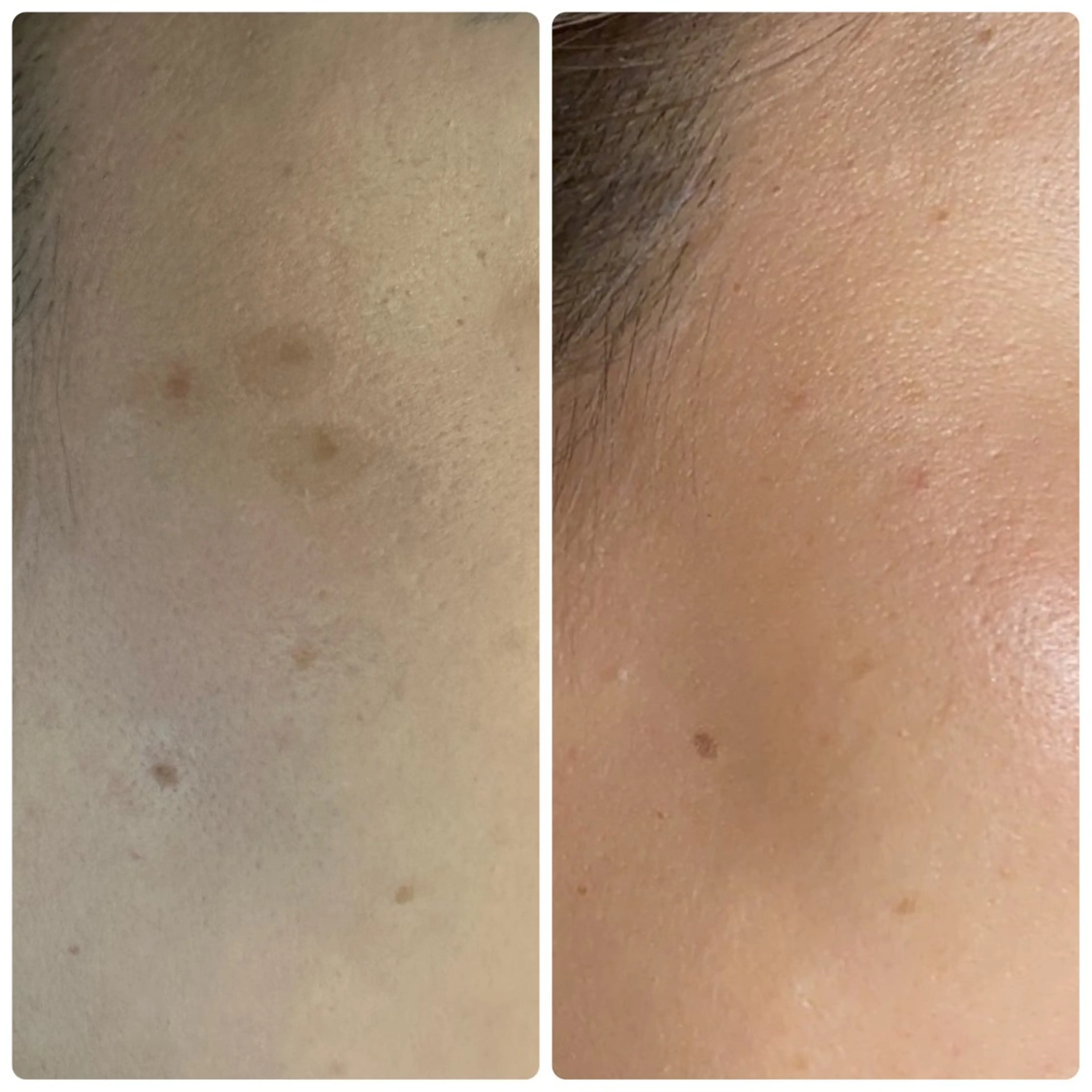 バストアップ専門/デ トックス/小顔コルギのエステ・リラクイメージ