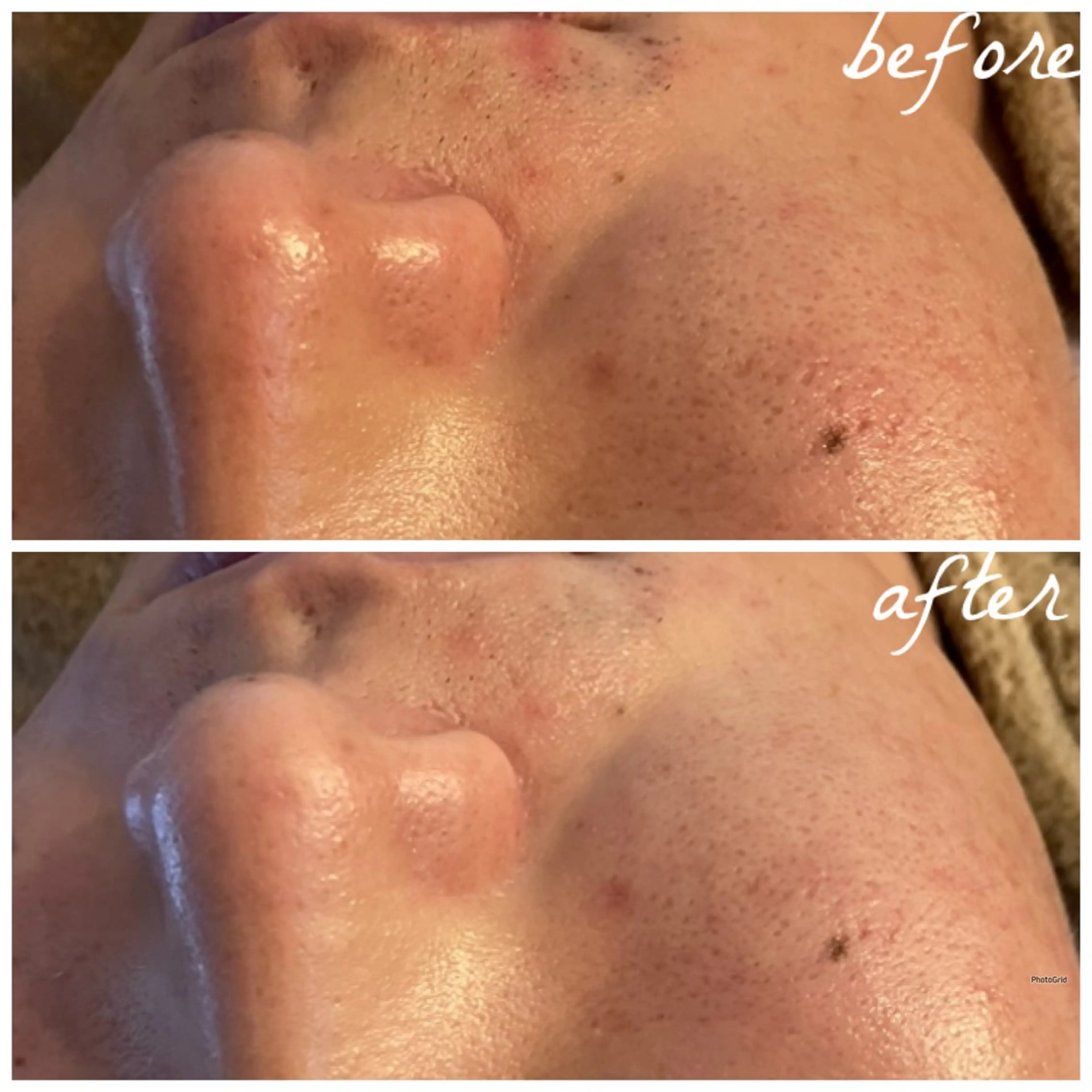 メンズ メナード岐阜茜部 杉浦のエステ・リラクイメージ