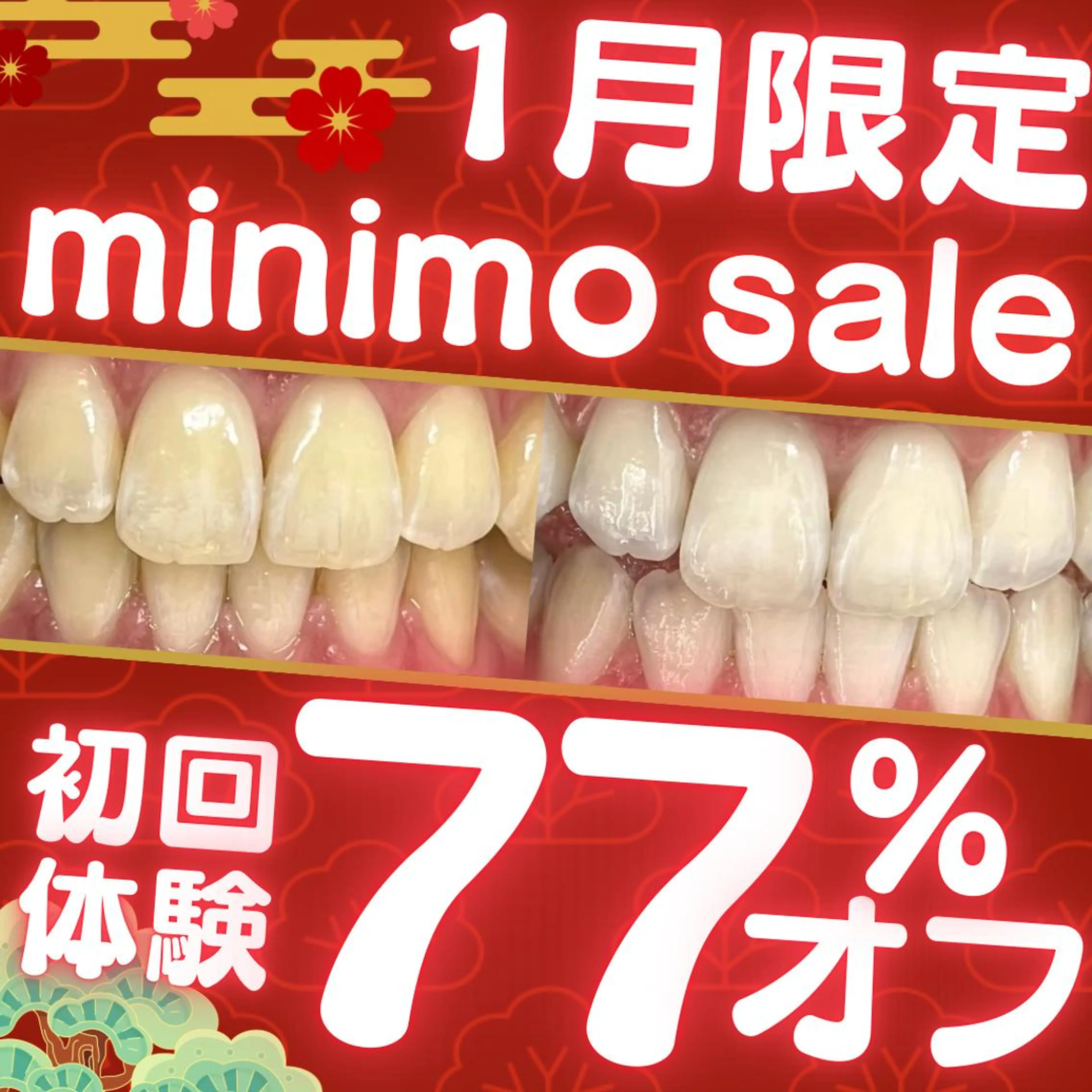 【1月限定❤️ミニモSALE❤️】8分照射×2回の定番メニュー💎セルフホワイトニングでツヤのある白い歯へ🦷の写真