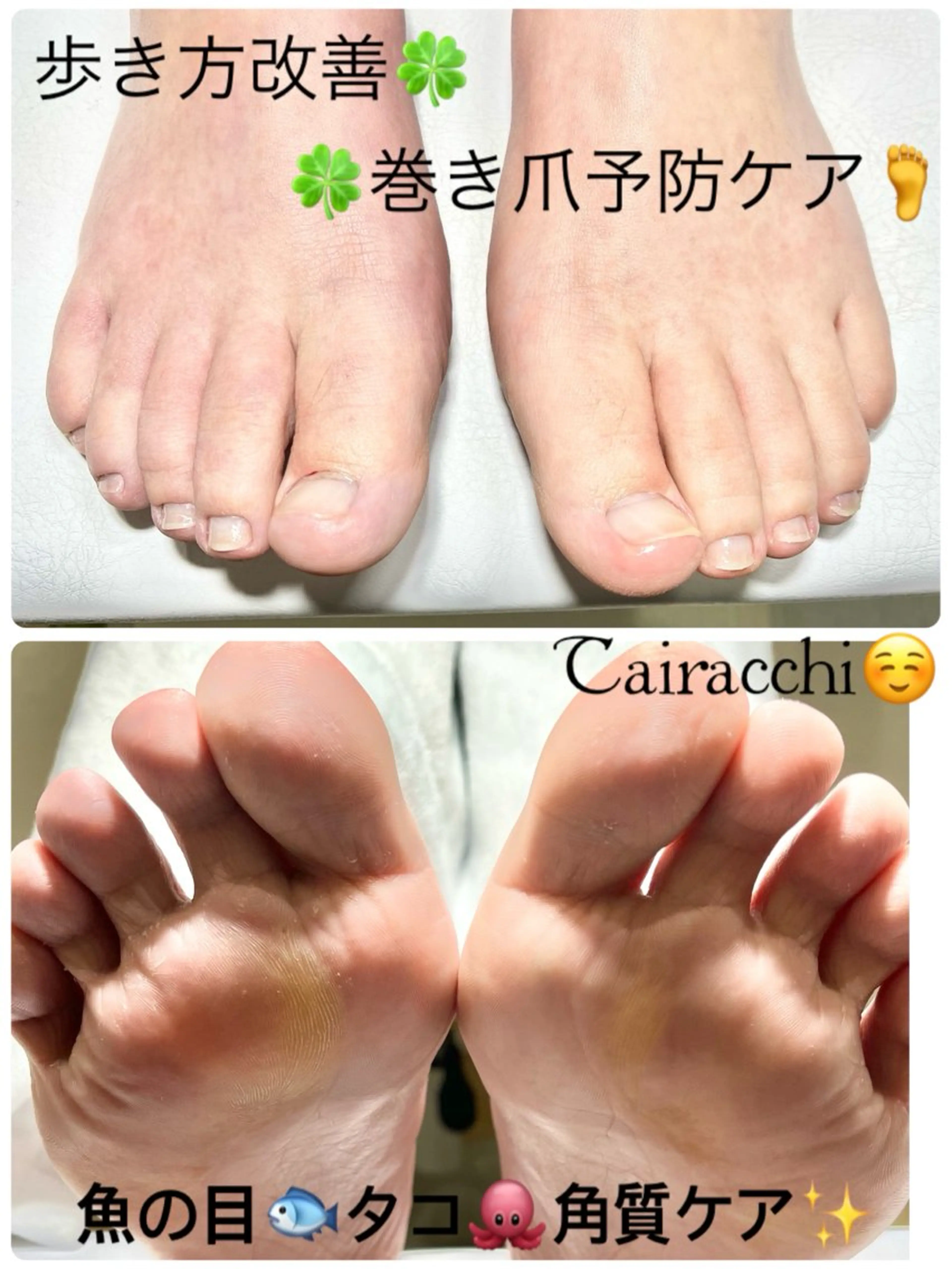 ネイル フットネイル フットネイル Tairacchi ﾀｲﾗｯﾁのエステ・リラクイメージ